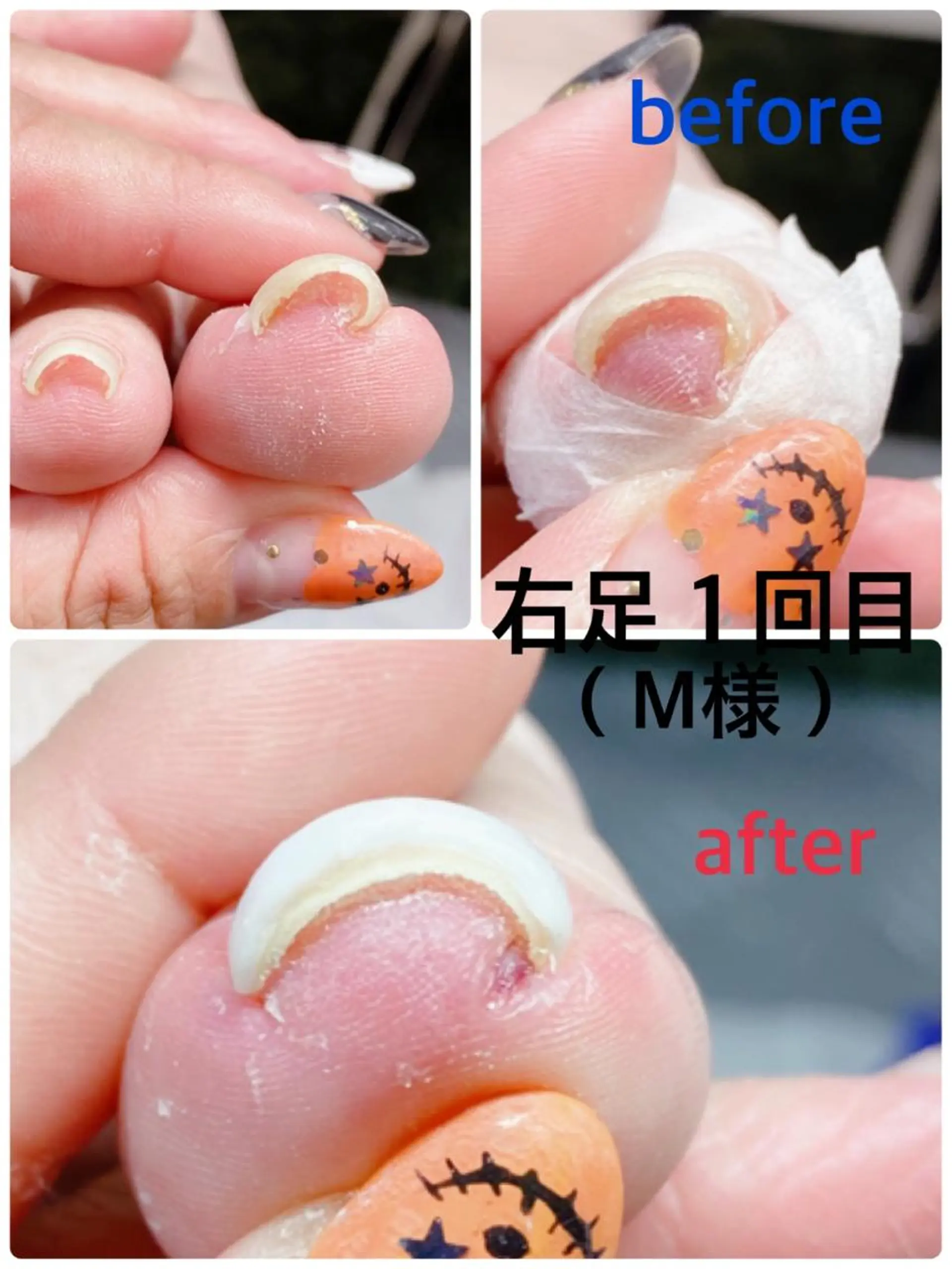 ネイル フットネイル 柴崎 美幸のネイルデザイン