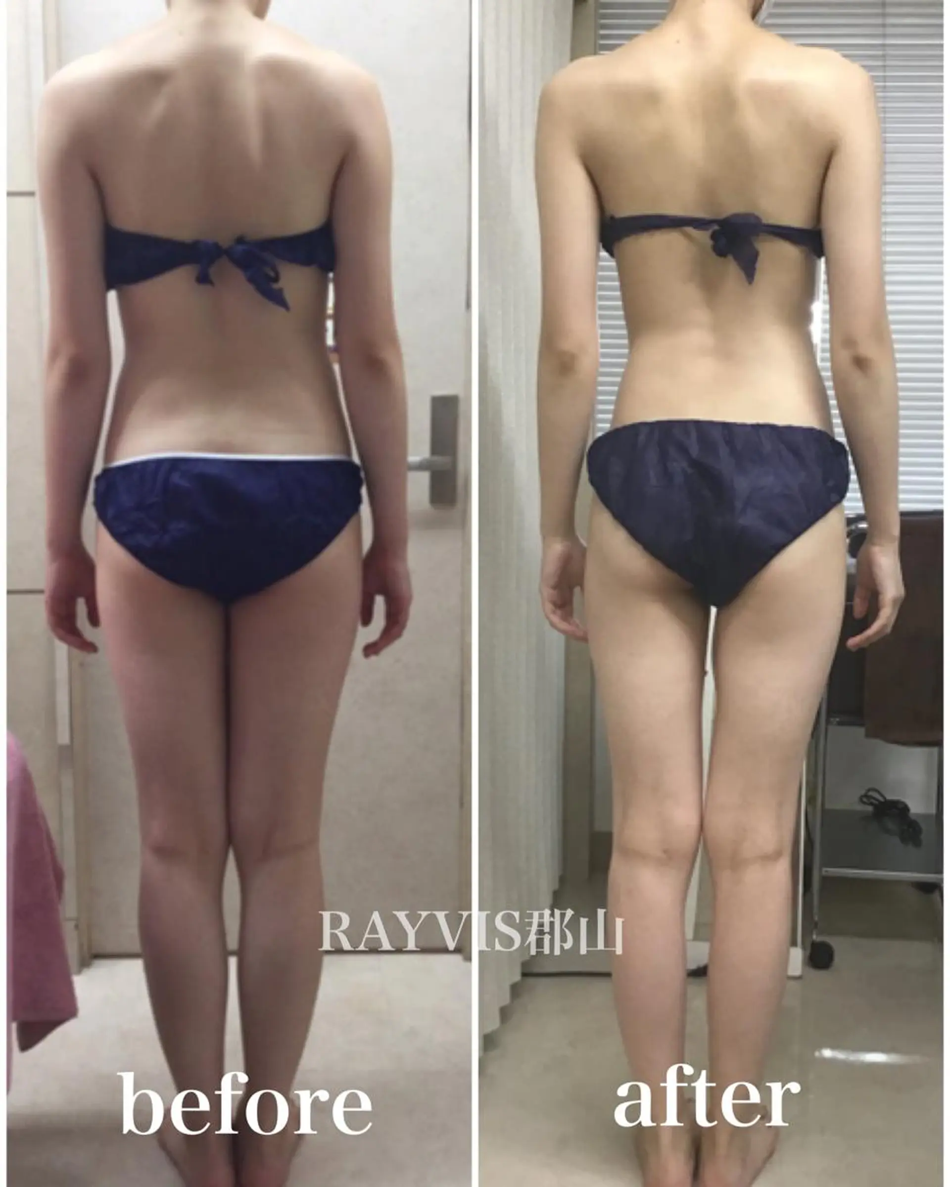 エステ 🩵RAYVIS🩵 郡山店のエステ・リラクイメージ