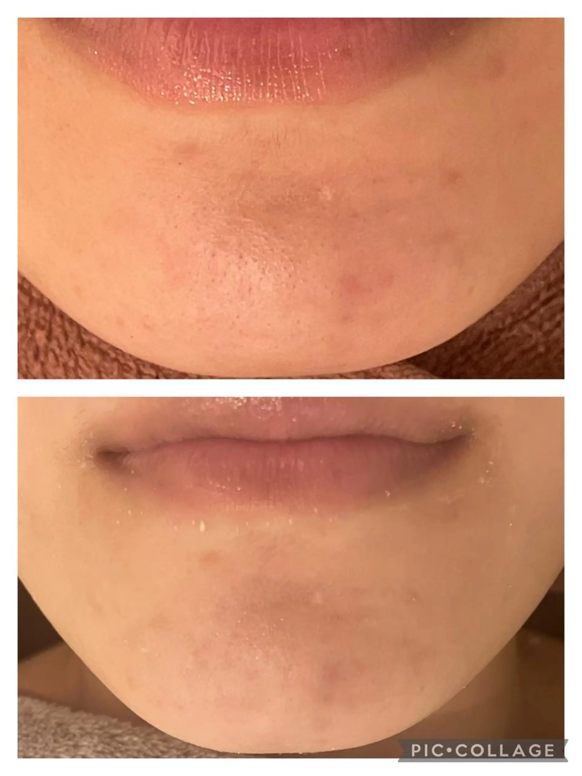 ロング カラー パーマ ヘアアレンジ メンズ キッズ ネイル マツエク・マツパ アイブロウ 🔥3か月で肌革命 🔥ニキビ専門店のエステ・リラクイメージ