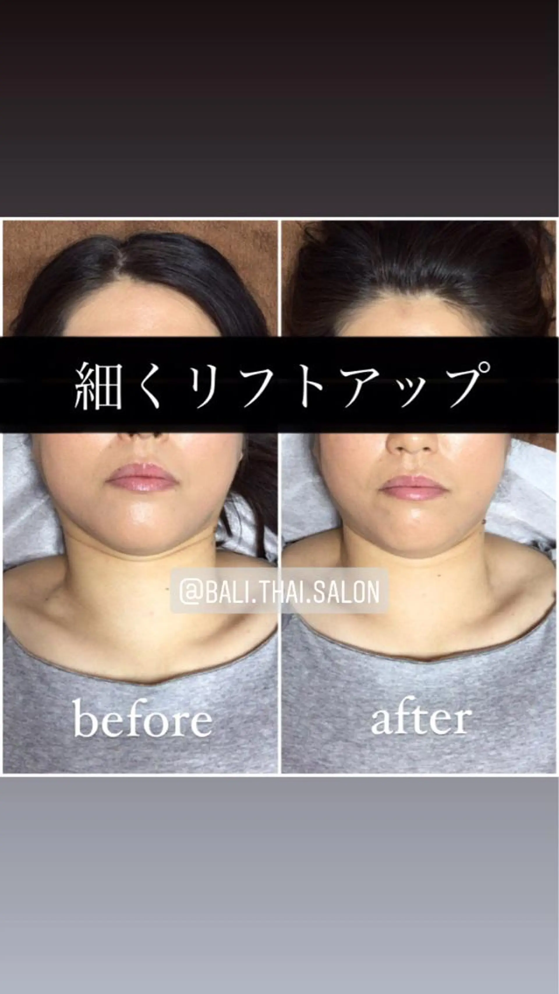 🌈歪み改善🌈 バリンタイ すぎうらのエステ・リラクイメージ