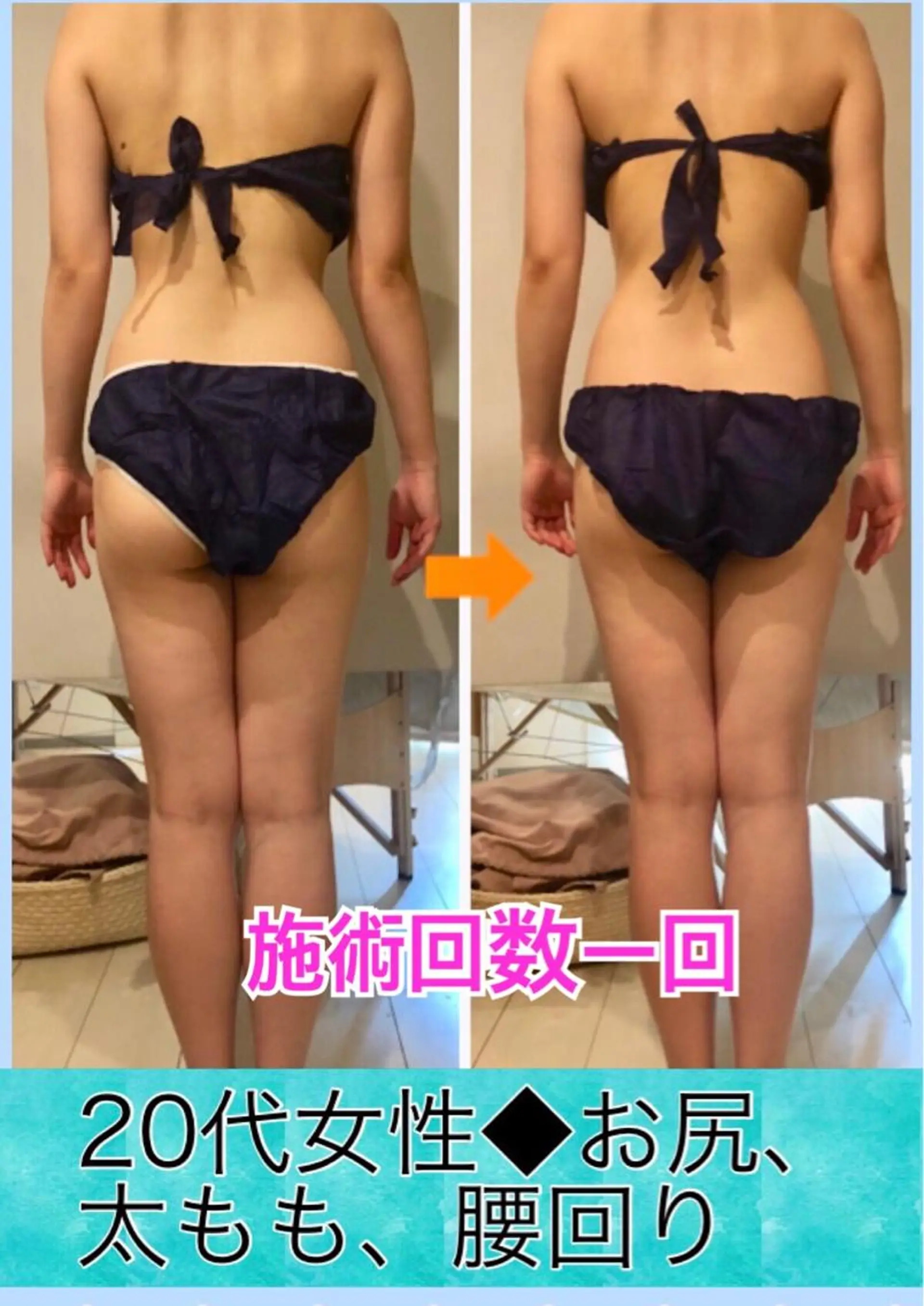 ロング カラー パーマ ヘアアレンジ メンズ キッズ ネイル マツエク・マツパ ‍痩身＆ボディ 結果出し🌟丹野のエステ・リラクイメージ