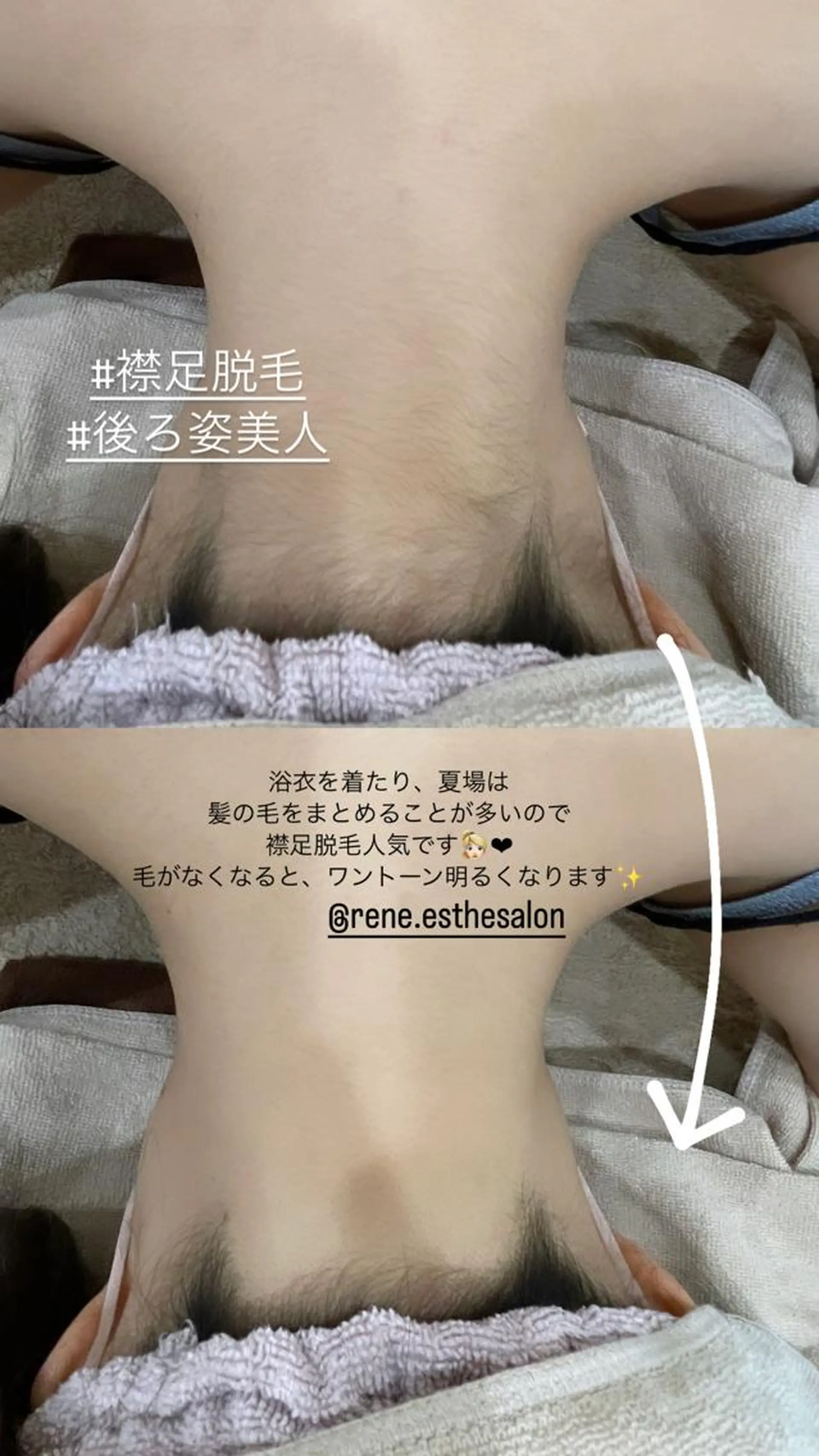 Rene 慢性疲労ケアサロンのエステ・リラクイメージ