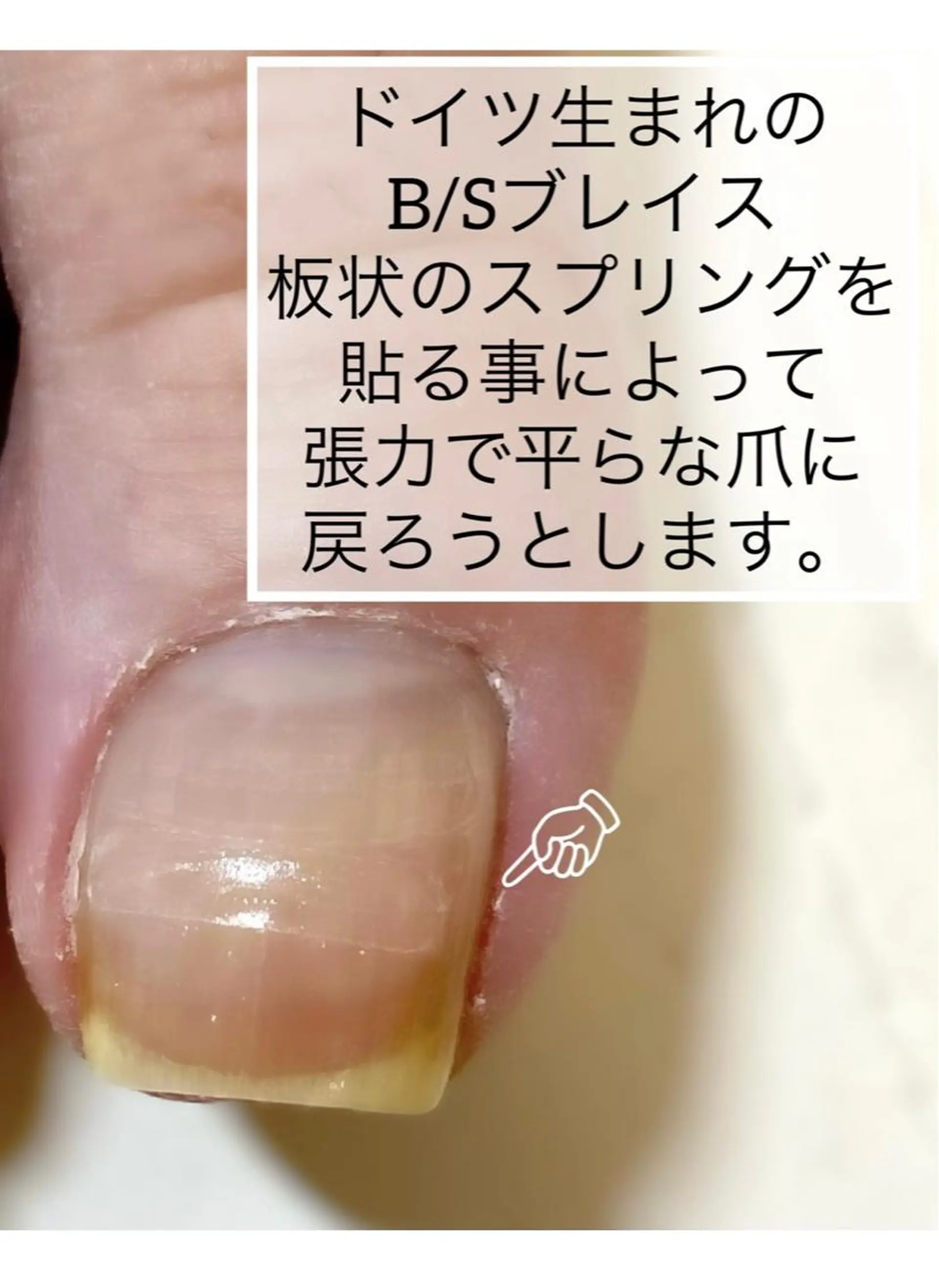 ネイル フットネイル JILL sa-yaのネイルデザイン