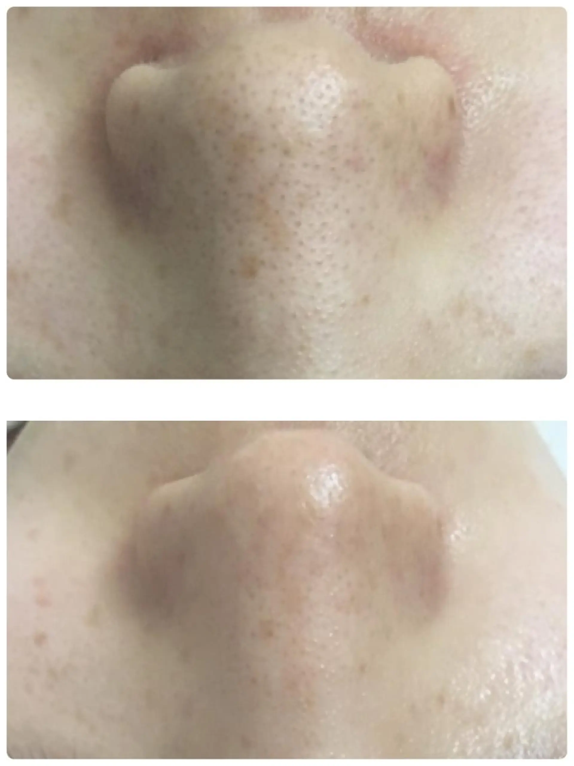 Meupニキビ専門店 背中/ハーブ/肌管理のその他イメージ