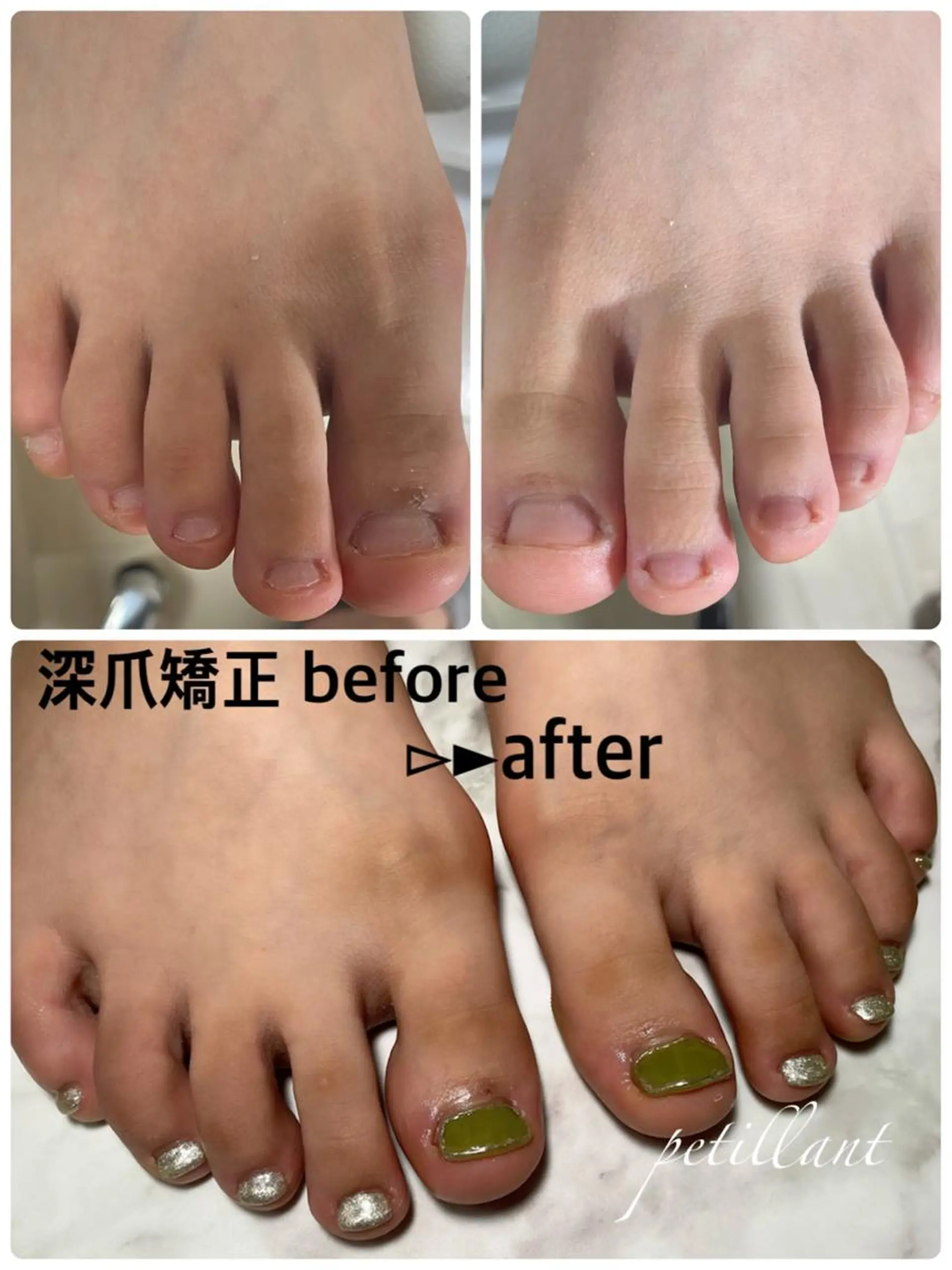 ネイル 長さ出し フットネイル petillant所属・nail salon petillantのネイルデザイン