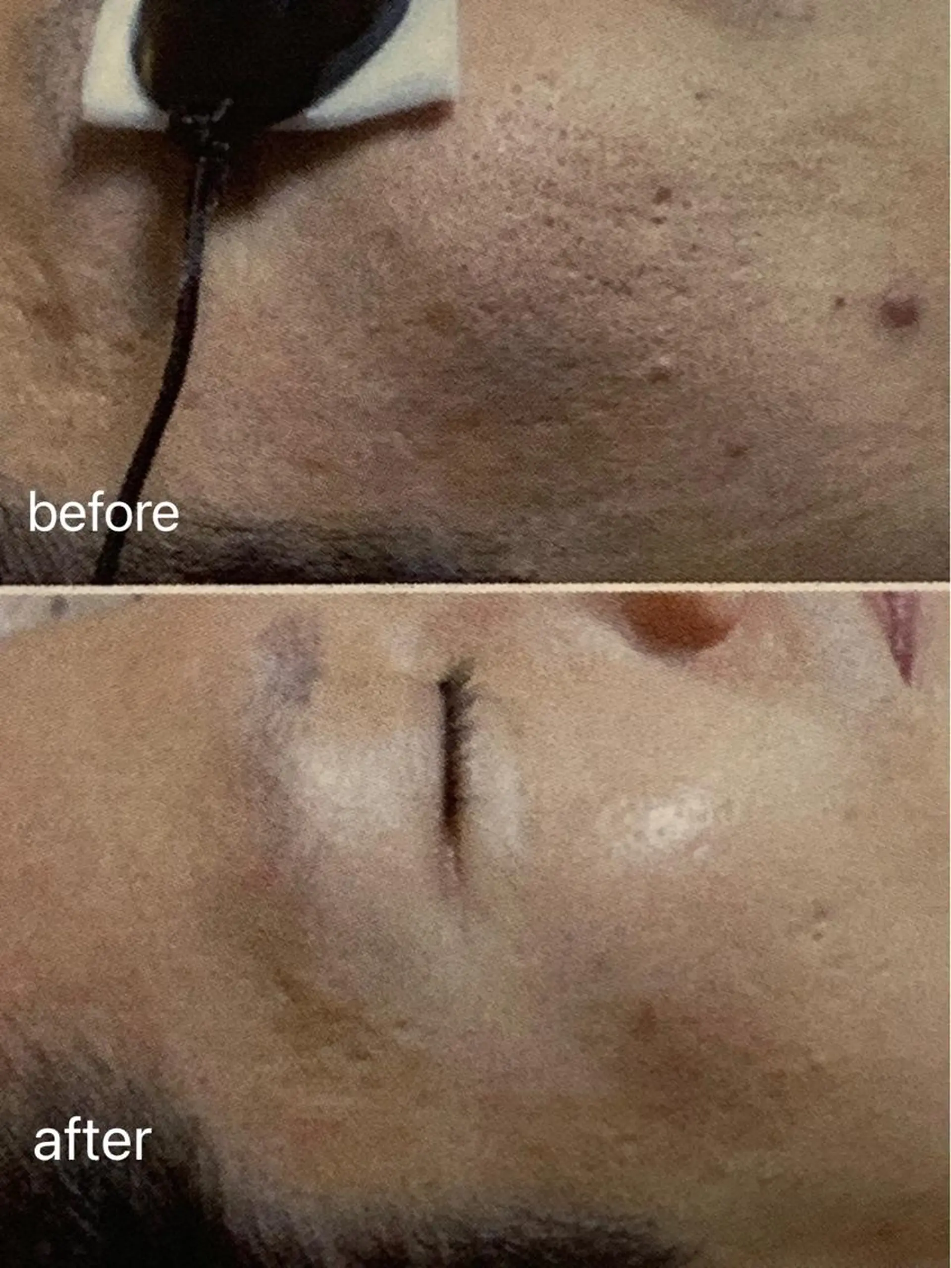 エステ M.rose エムローズのエステ・リラクイメージ