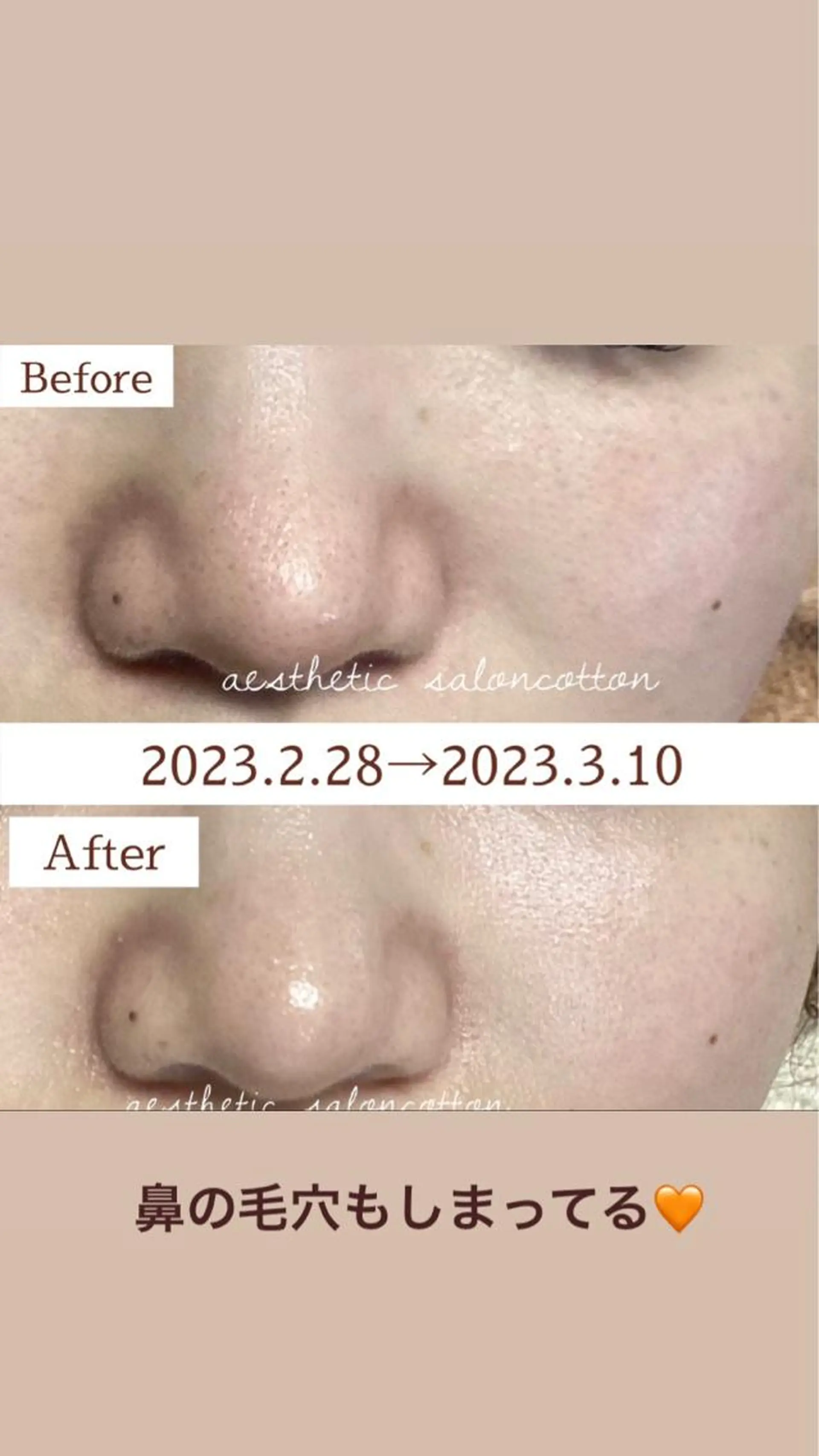 都度払い 肌質改善専門サロンのエステ・リラクイメージ