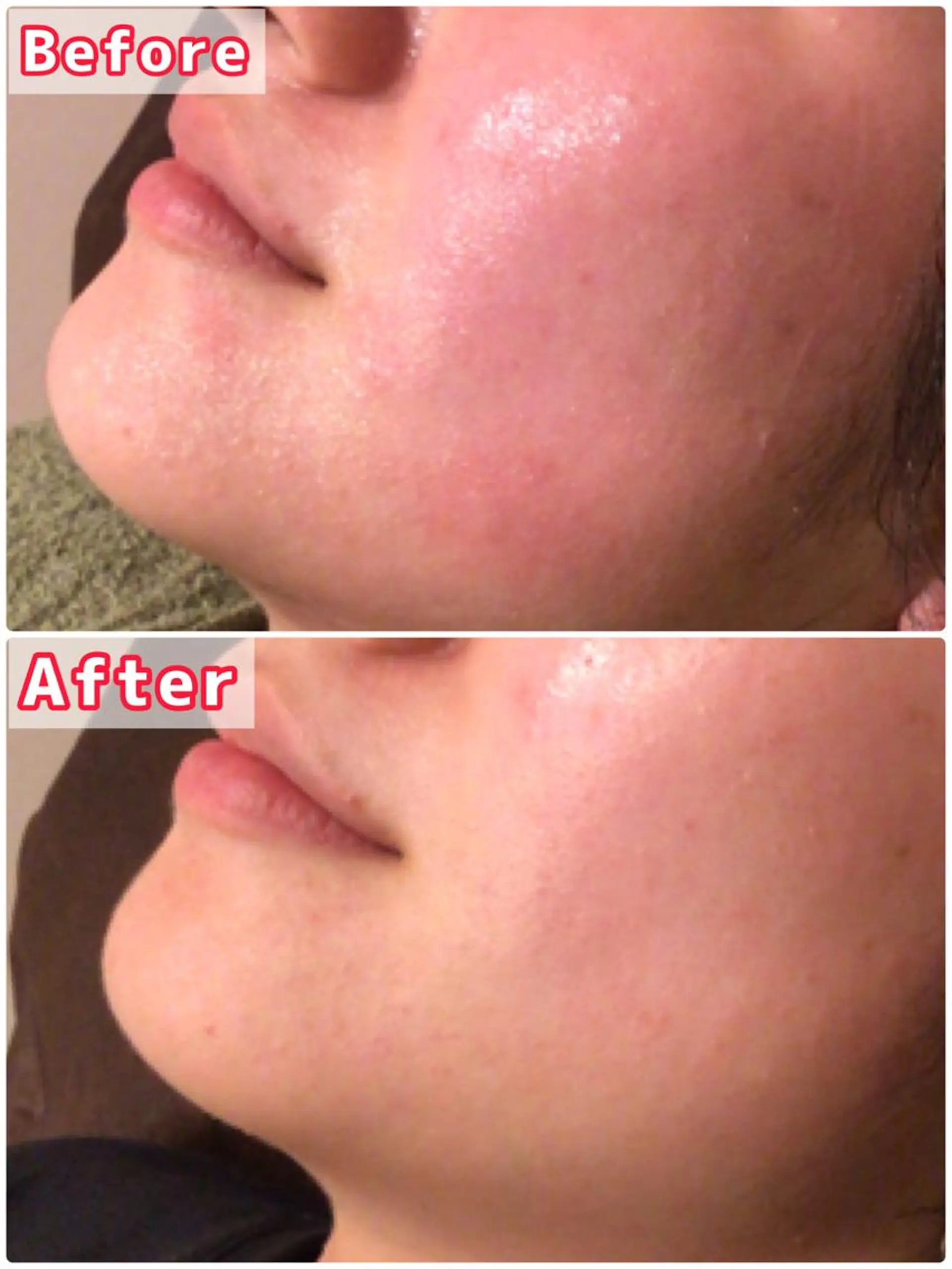 ハーブピーリング専門 muro.のエステ・リラクイメージ