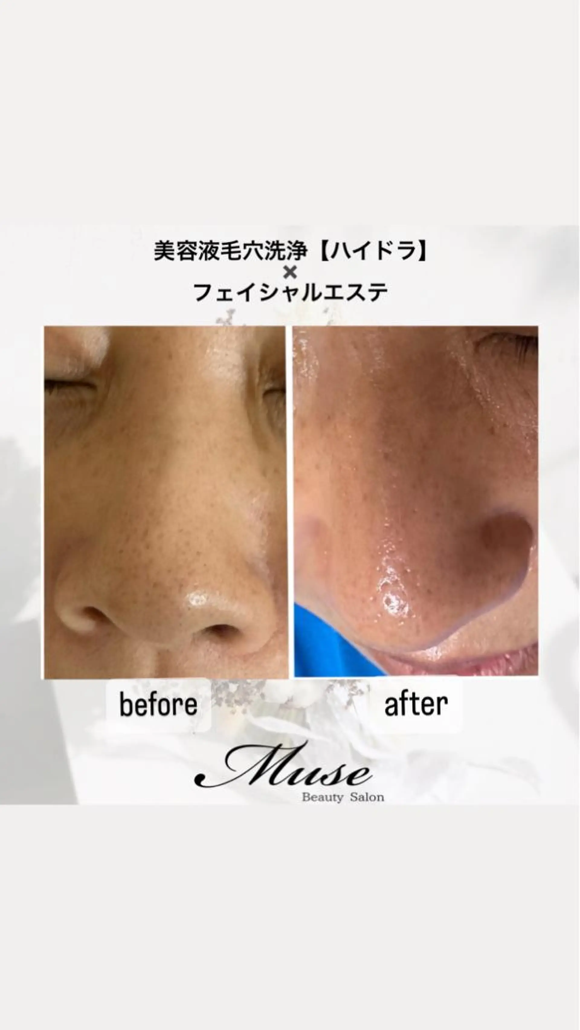 医療提携Beauty SalonMuseのエステ・リラクイメージ