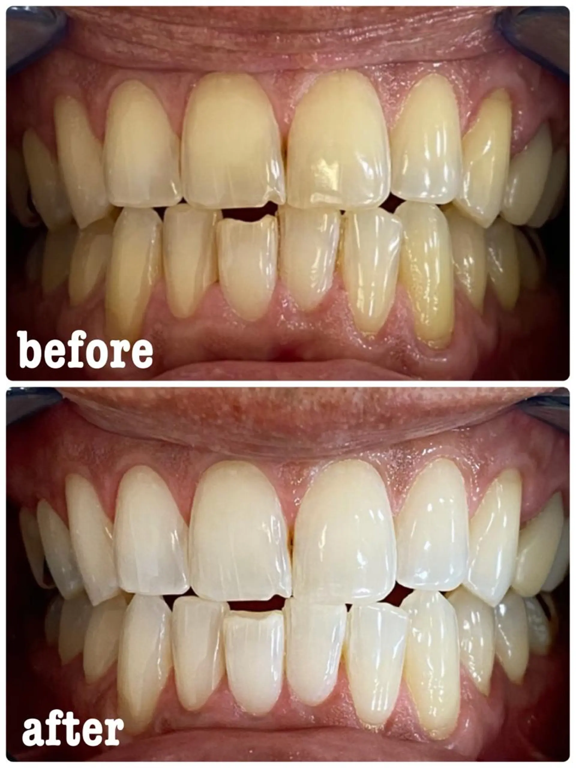 ホワイトニングサロン ラウレアのその他イメージ