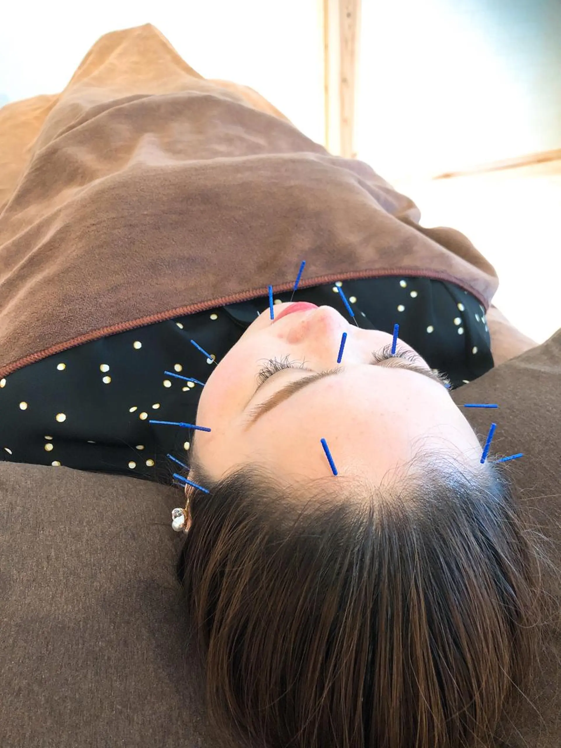 HARIKA鍼灸所属・HARIKA 鍼灸のその他イメージ