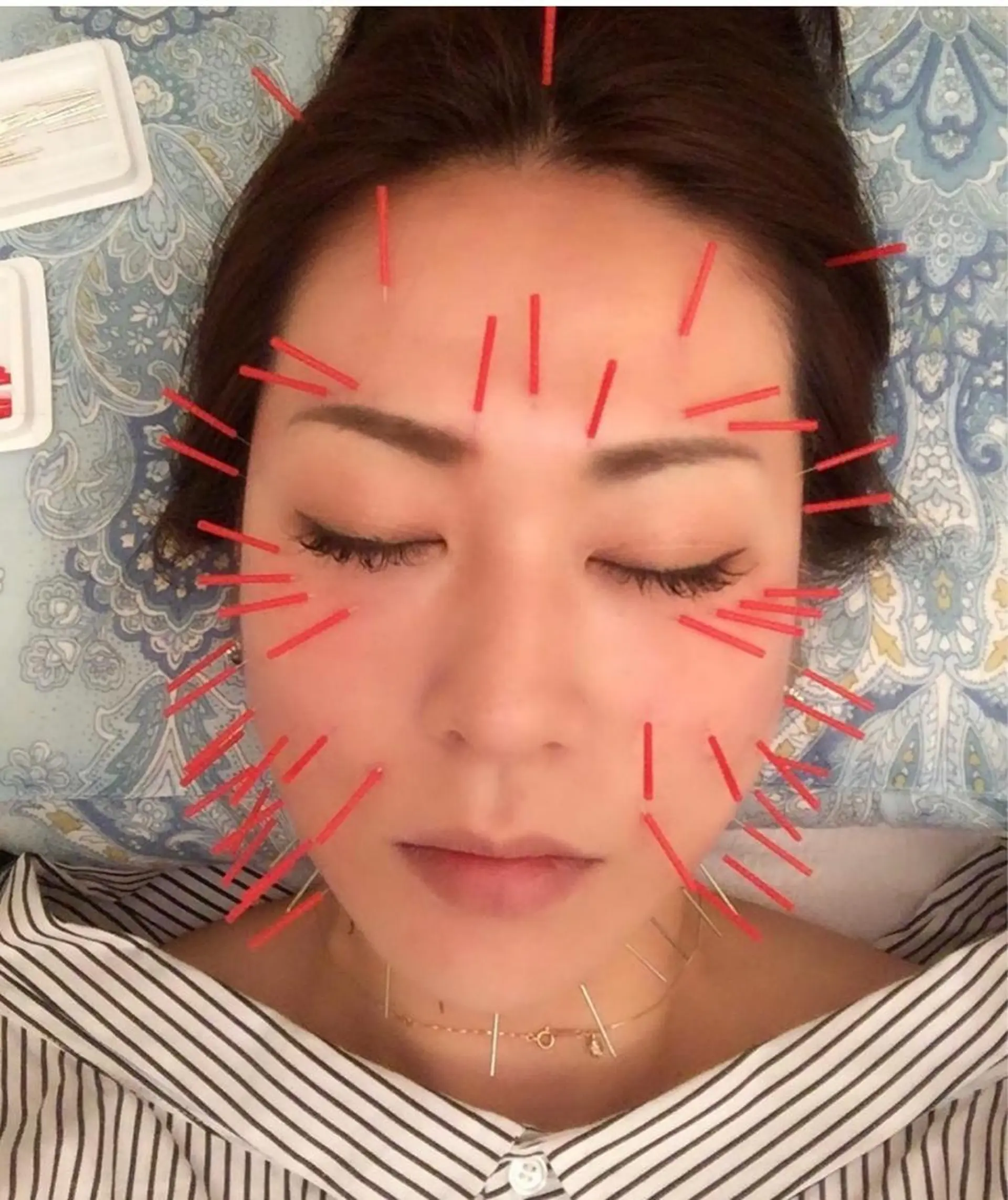 美容鍼灸サロン mahoroba院長のエステ・リラクイメージ