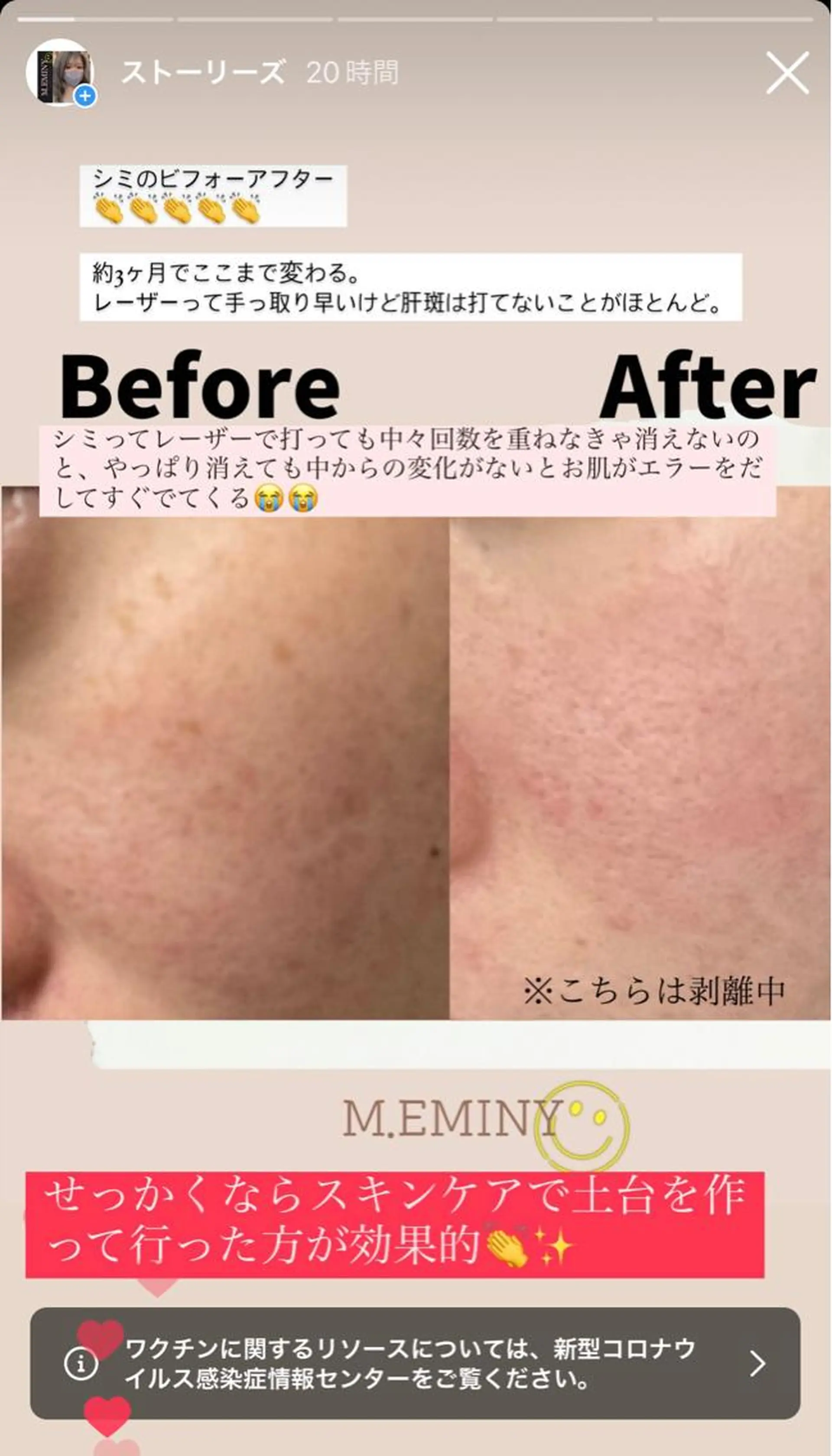 脱毛 &relaxation　M.EMINY所属・大分賀来リラクサロン M.EMINYのエステ・リラクイメージ