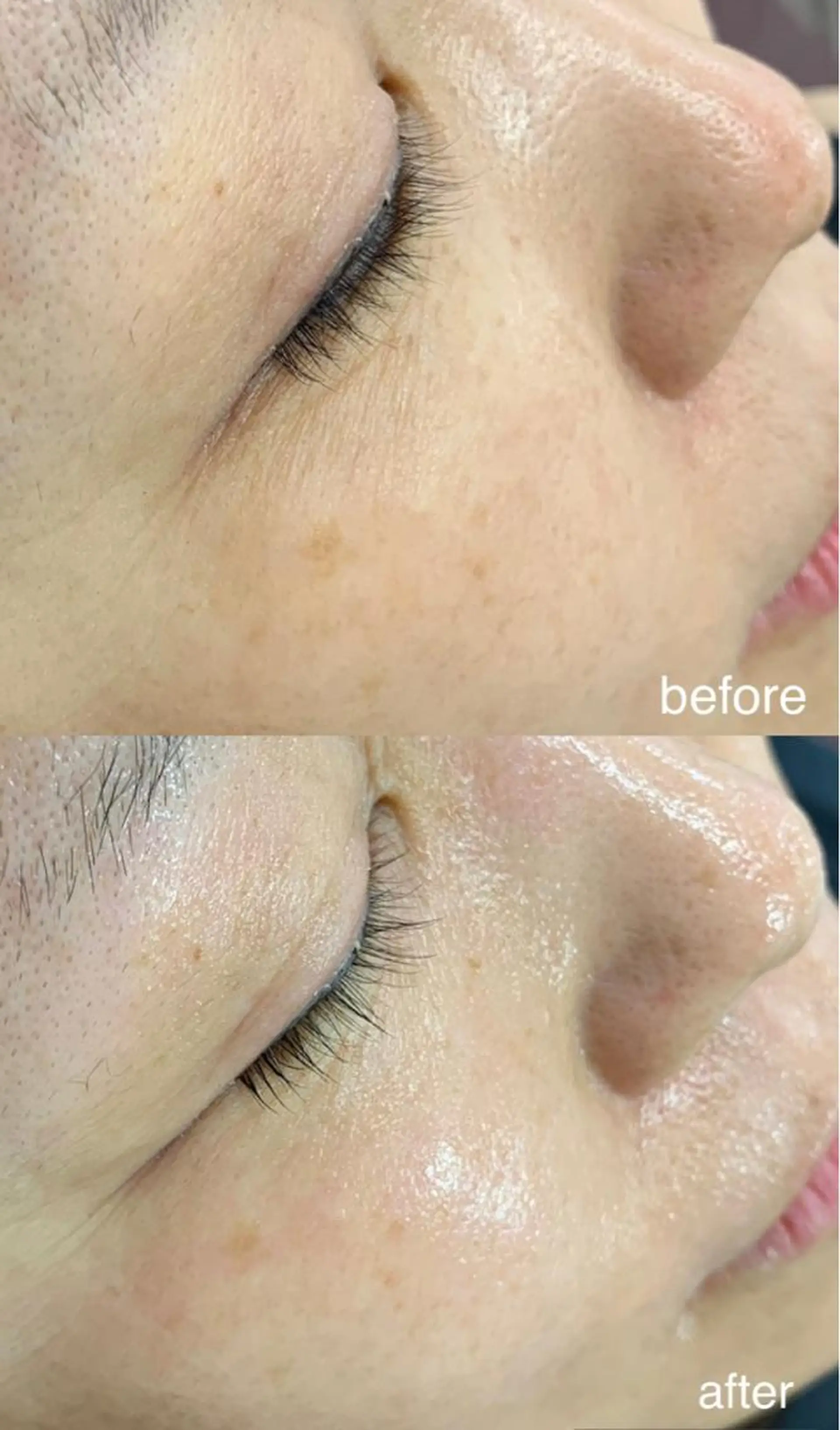 エステ Lavi&所属・肌質改善サロン Lavi&のその他イメージ