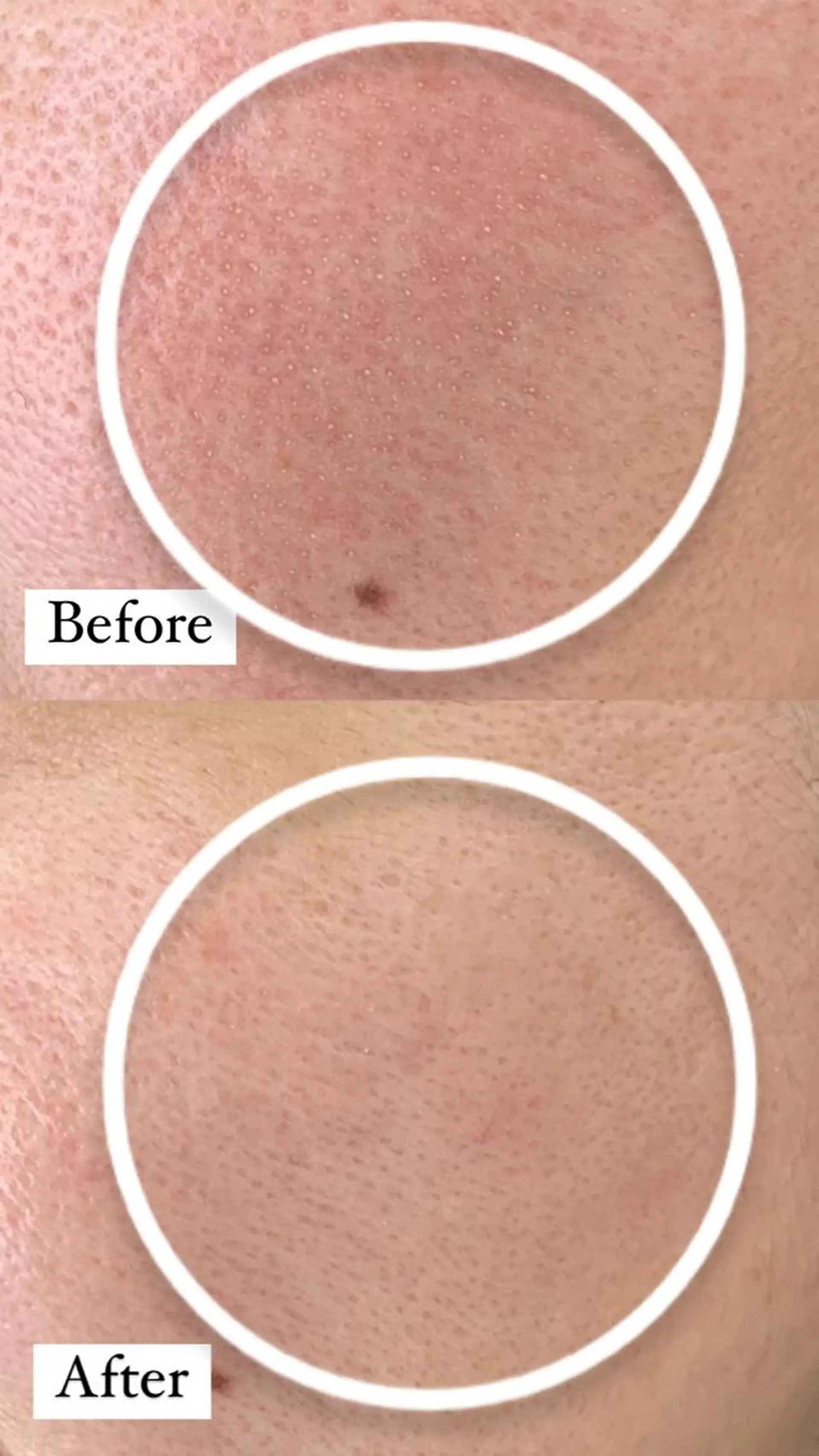 デ・アイム新潟　　北所属・山口 萌のエステ・リラクイメージ