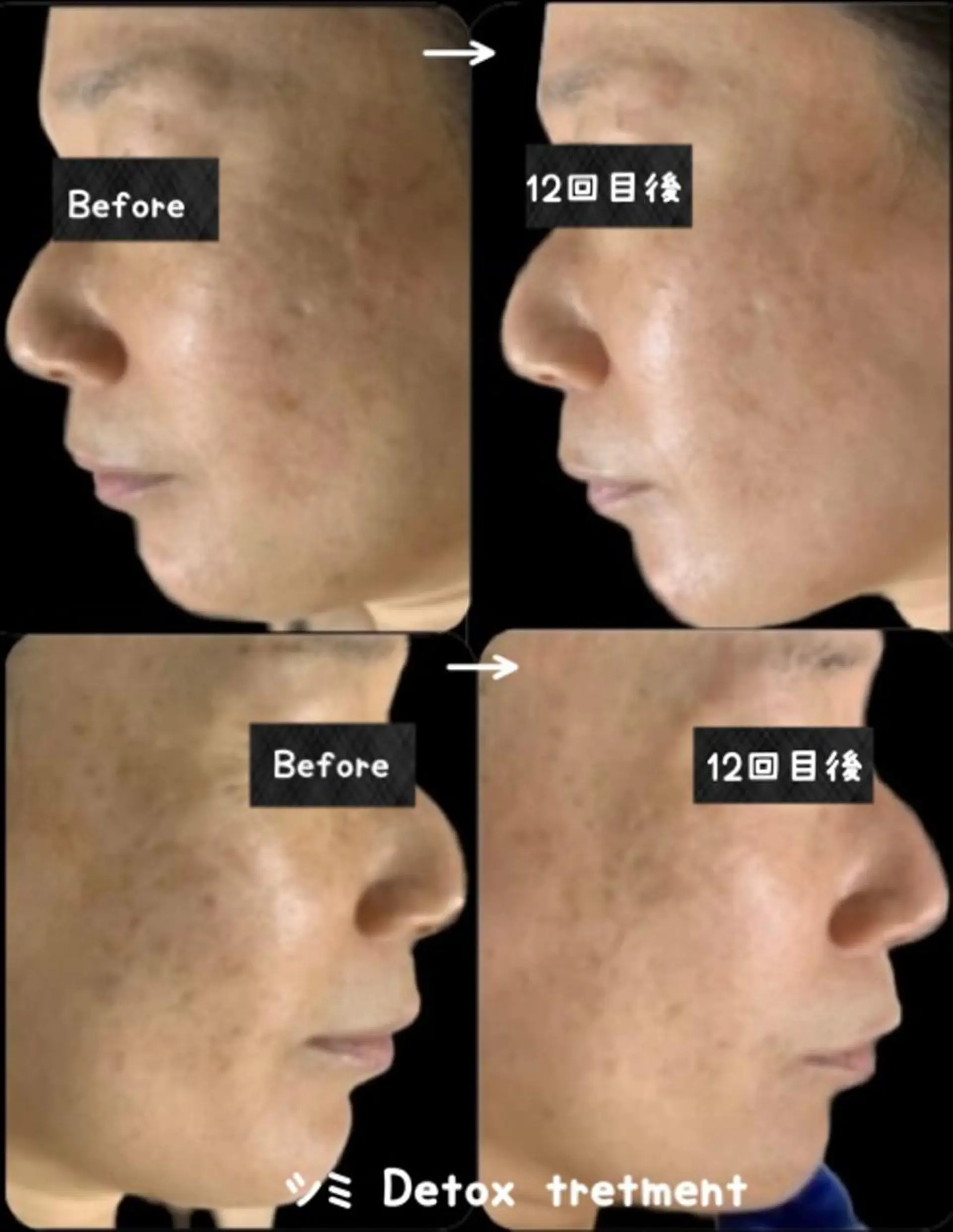 エステ ヴィーナス ビューティーのエステ・リラクイメージ