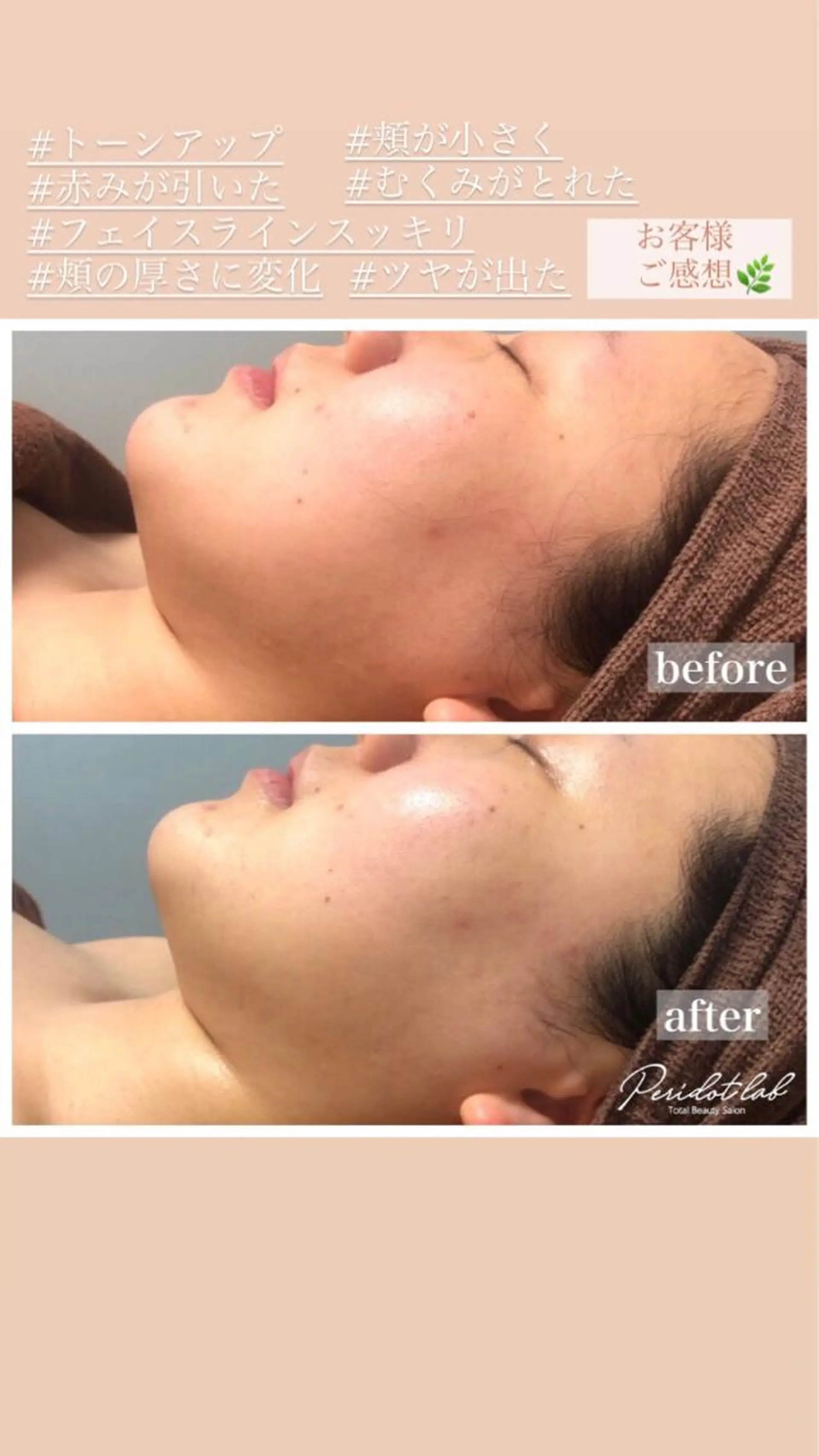 エステ リラク ペリドットラボ naoのエステ・リラクイメージ