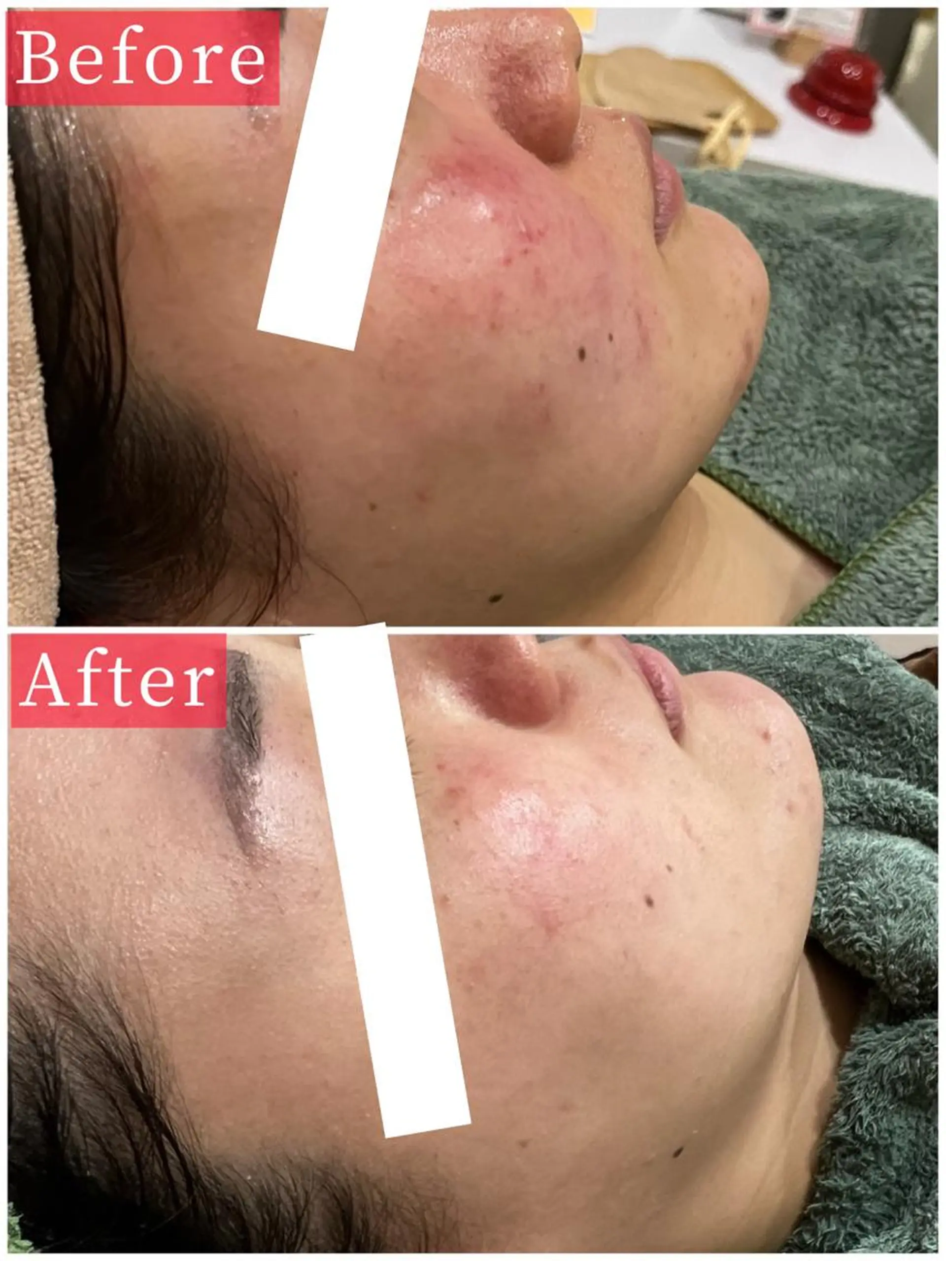 ハーブピーリング専門 muro.のエステ・リラクイメージ