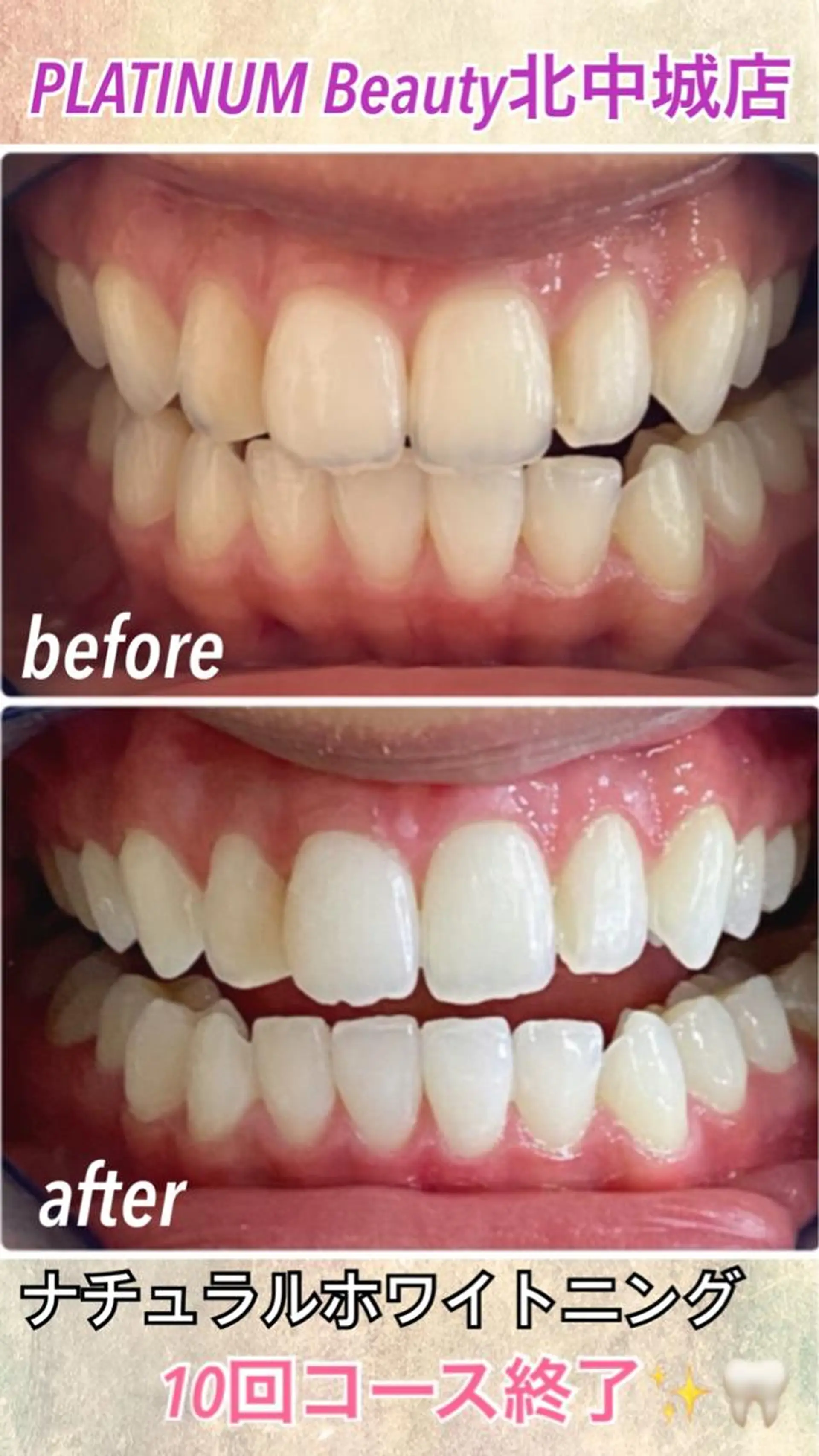 その他 ホワイトニングサロン ラウレアのその他イメージ