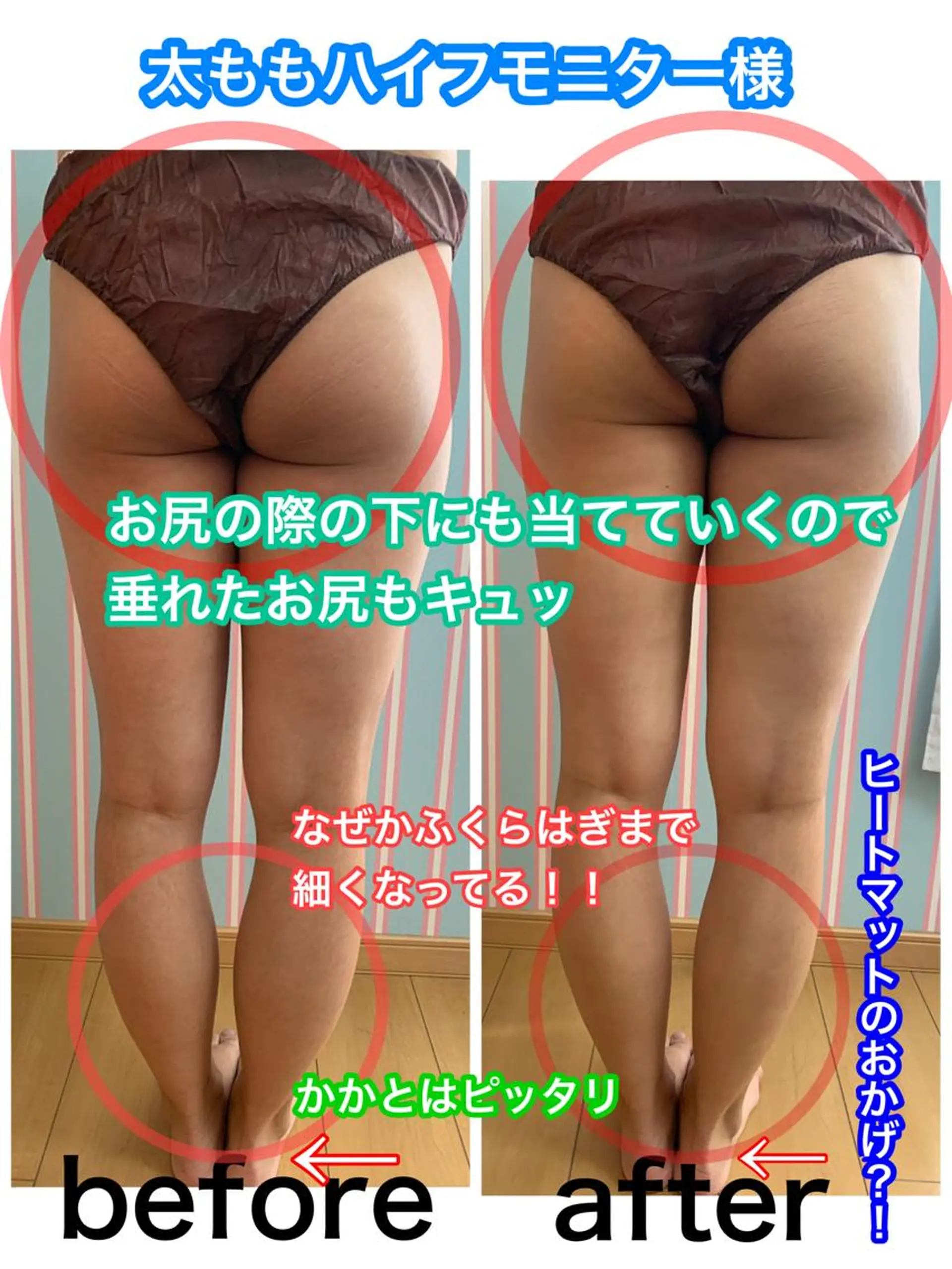 エステ 痩身/脱毛/ネイル HARUKAのエステ・リラクイメージ