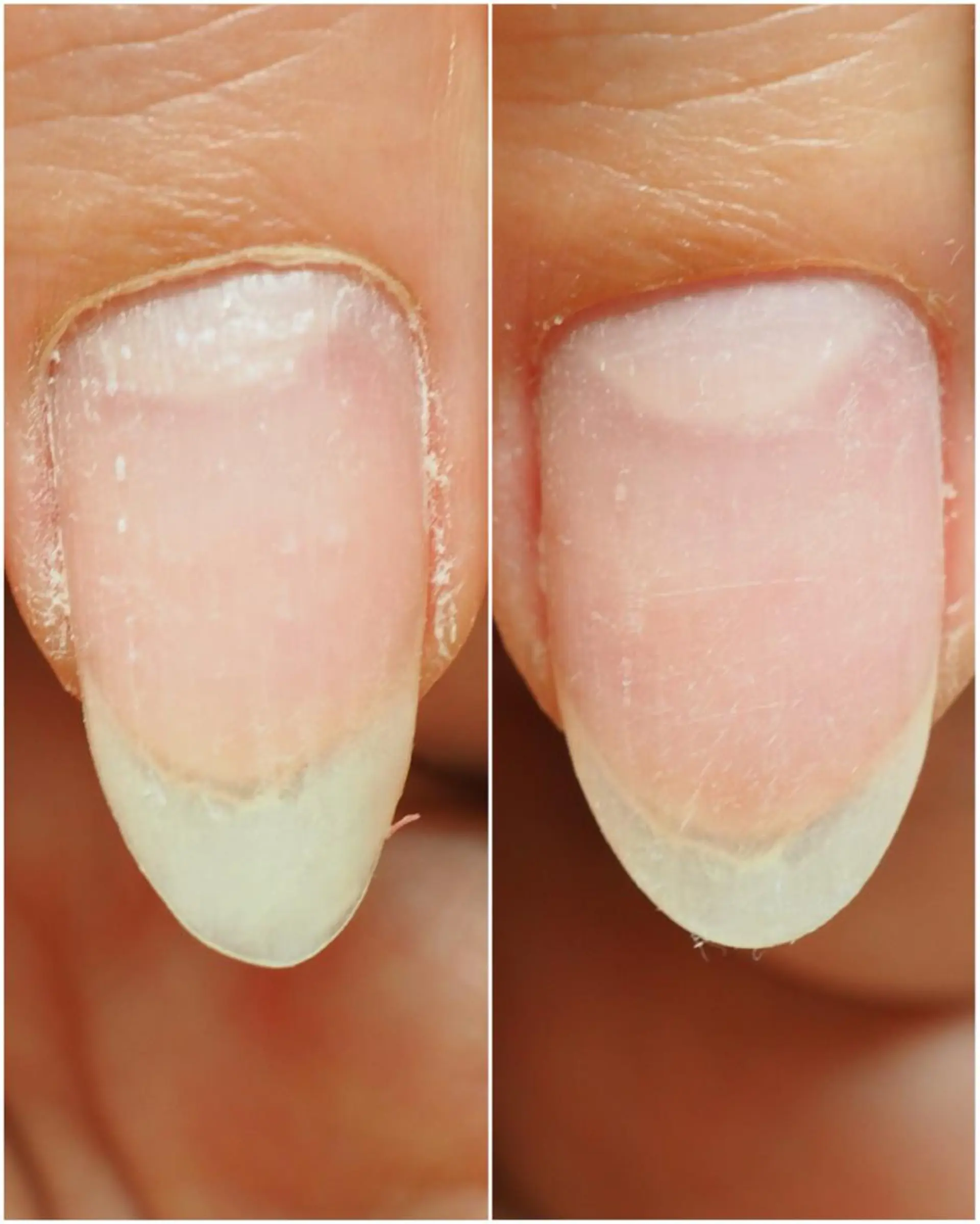 ネイル ピンク ネイルアーティスト アリスのネイルデザイン