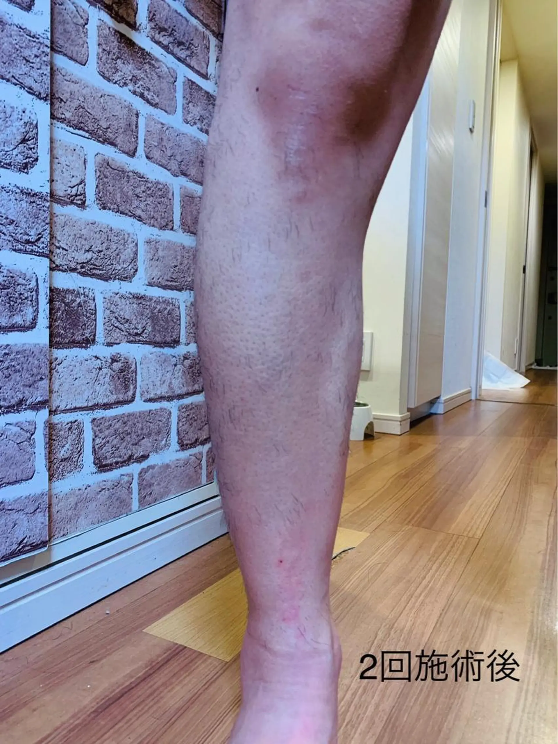 ネイル・脱毛サロンplage所属・脱毛サロン Plageプラージュのエステ・リラクイメージ