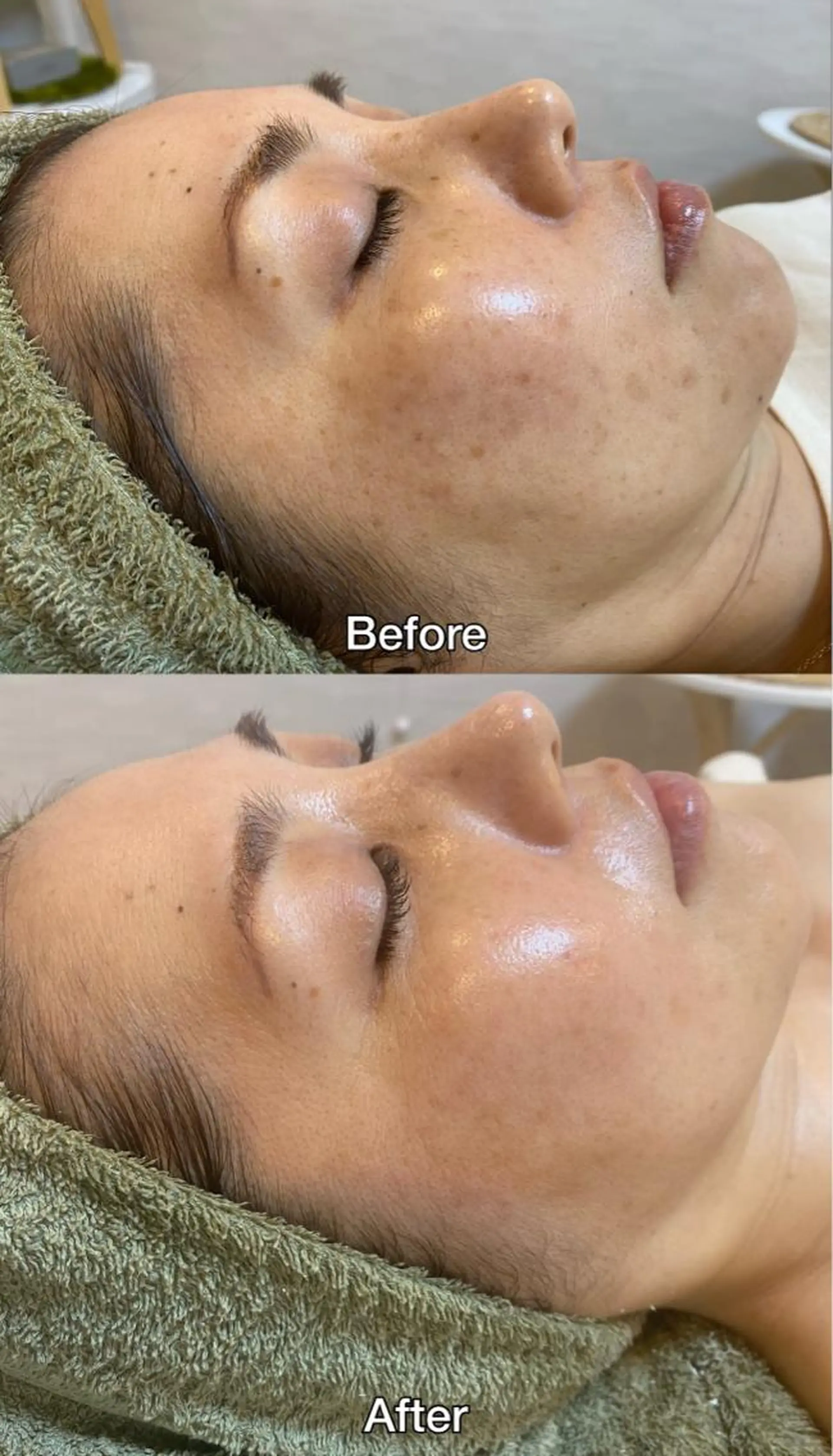 脱毛｜ピーリング ROOM.Sのエステ・リラクイメージ