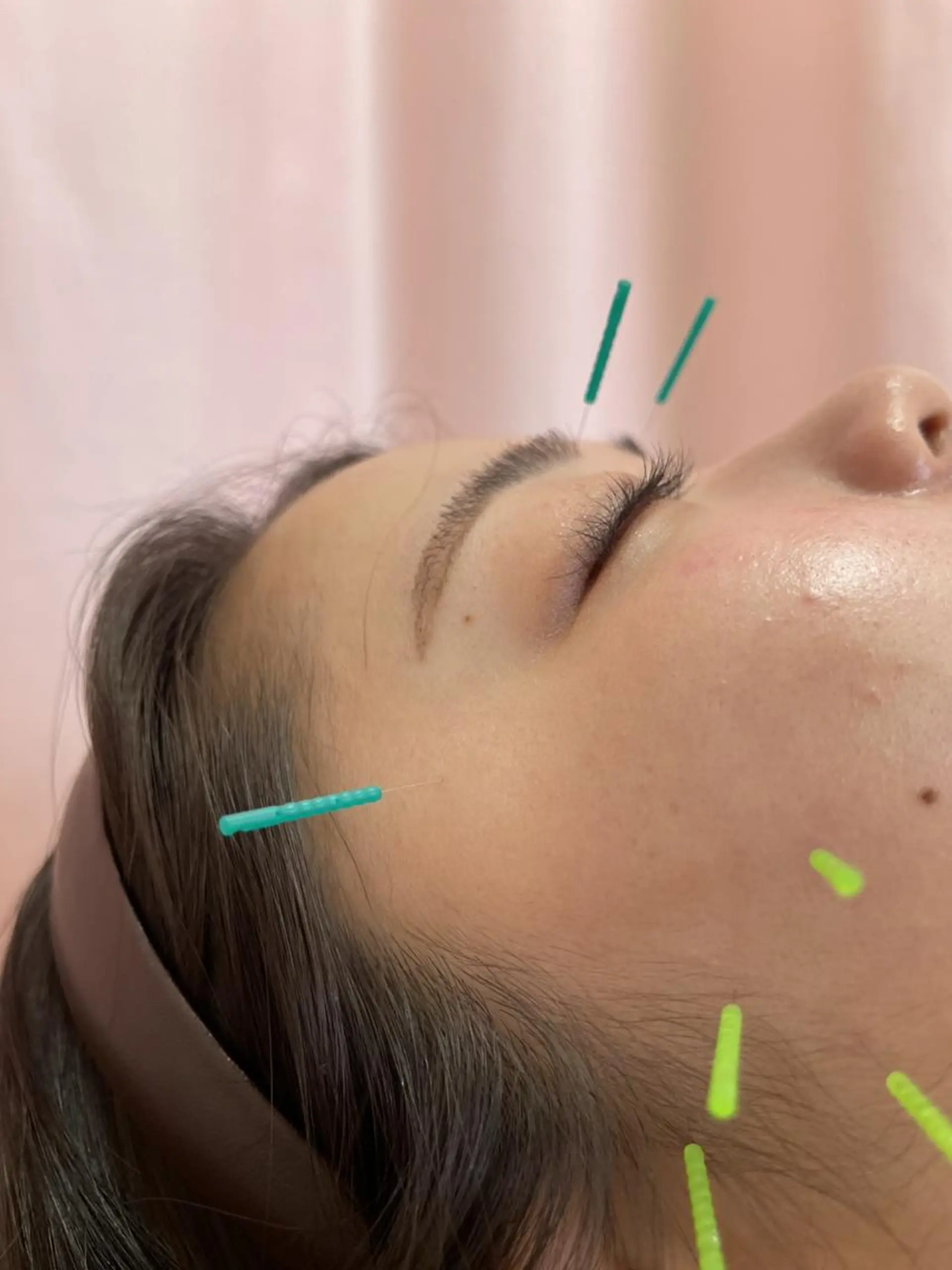 エステ リラク 同心整骨院 美容鍼・整体・小顔のエステ・リラクイメージ