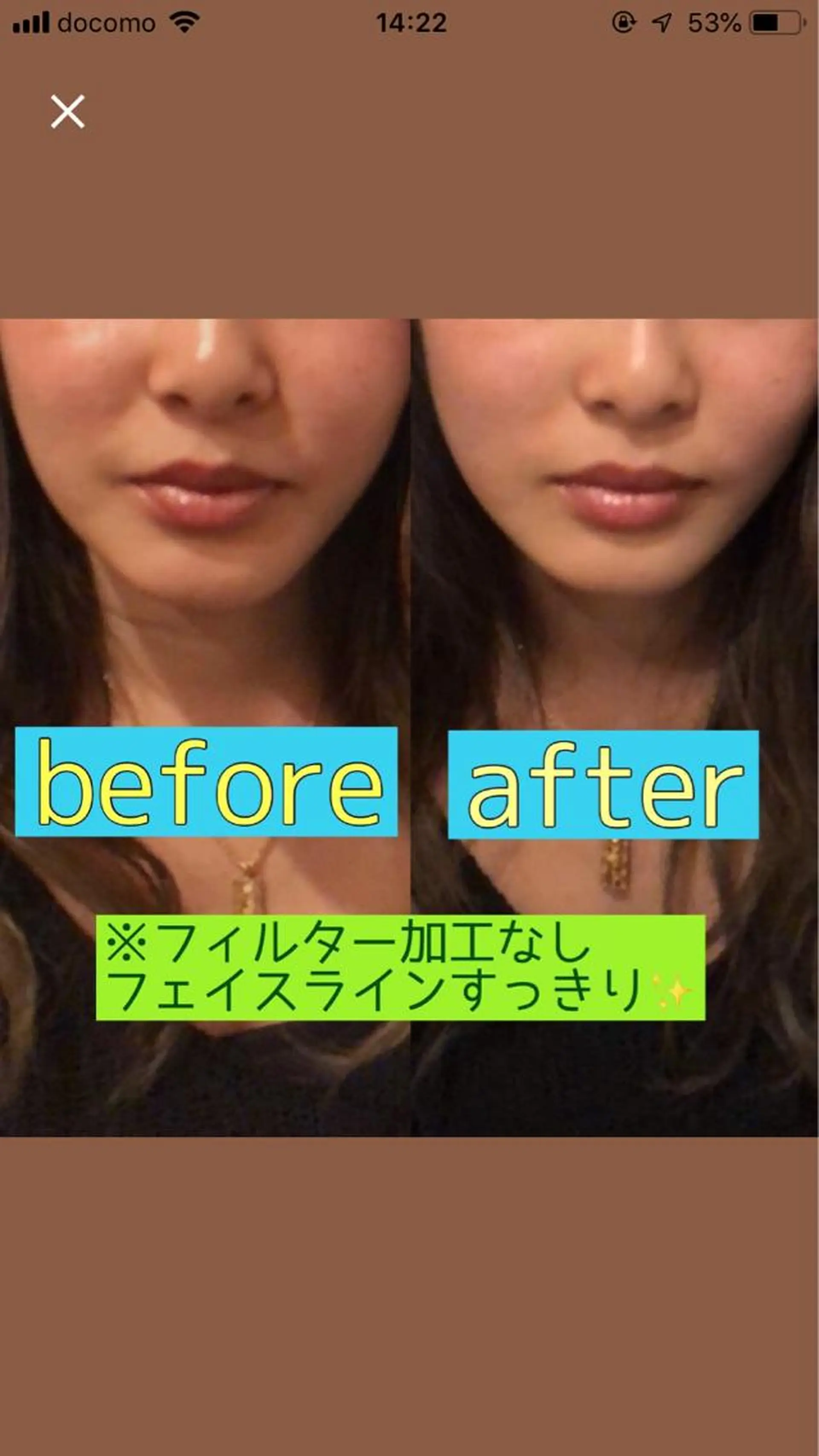 小顔矯正・美容鍼 美鍼堂のエステ・リラクイメージ