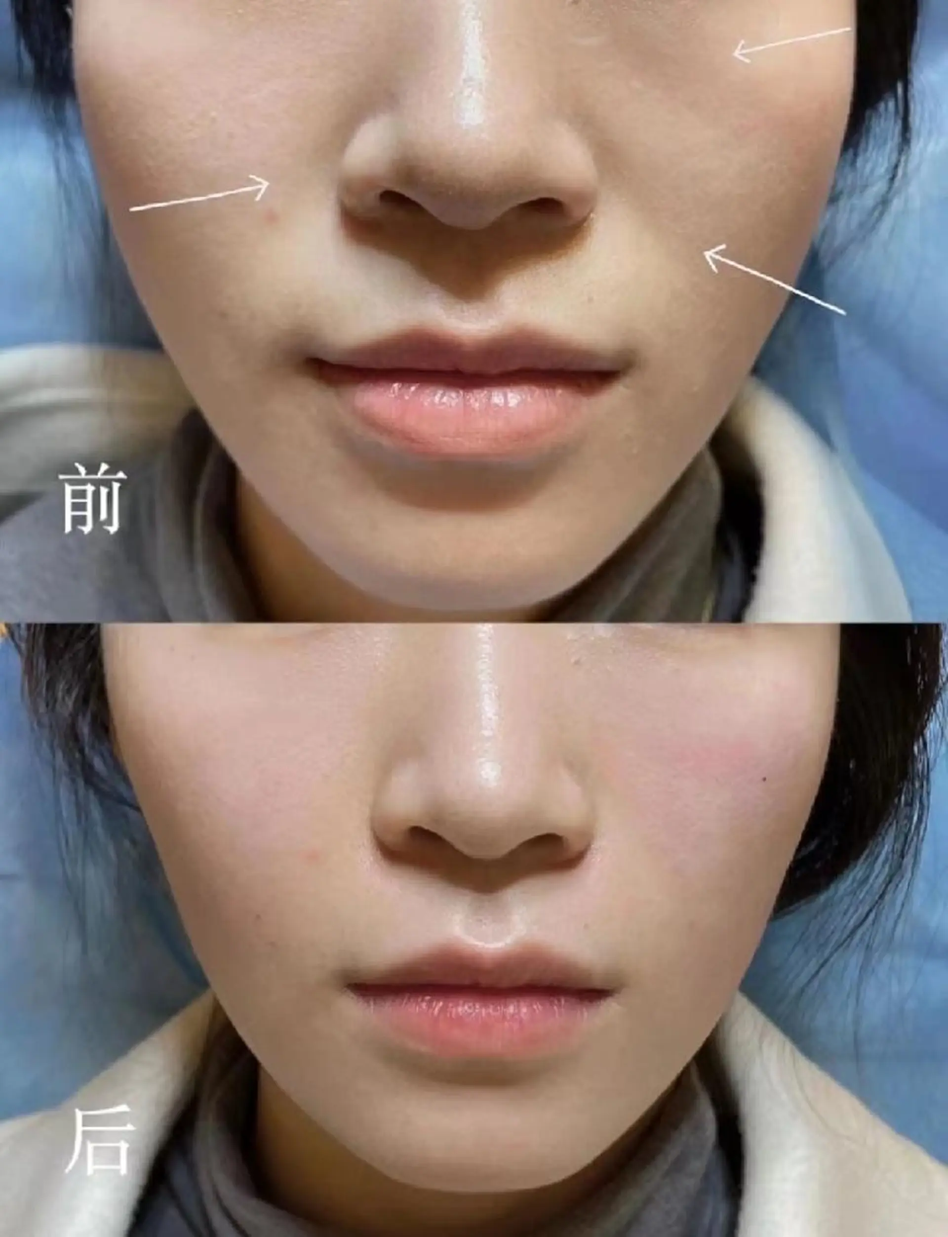 ショート 小顔カット エステ aliaハイフ&水光ジェットサロン所属・aliaハーブ水光店 エステティシャン募集のエステ・リラクイメージ