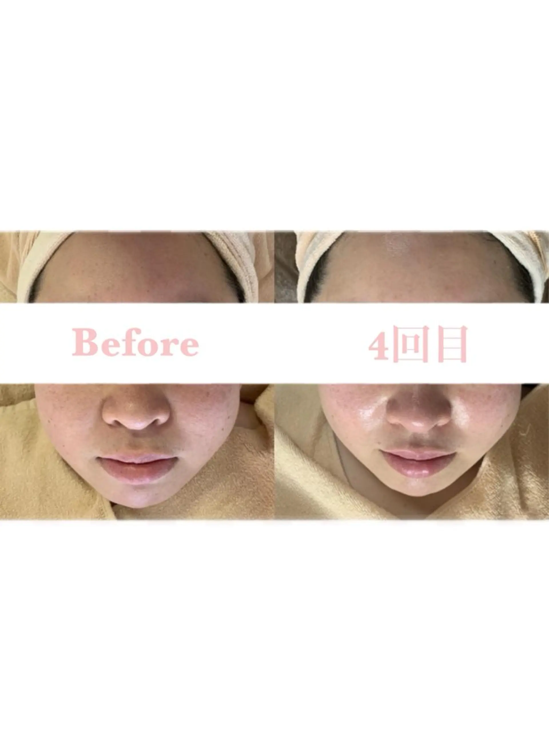 Lilas 【リラ】 小野かづさのエステ・リラクイメージ