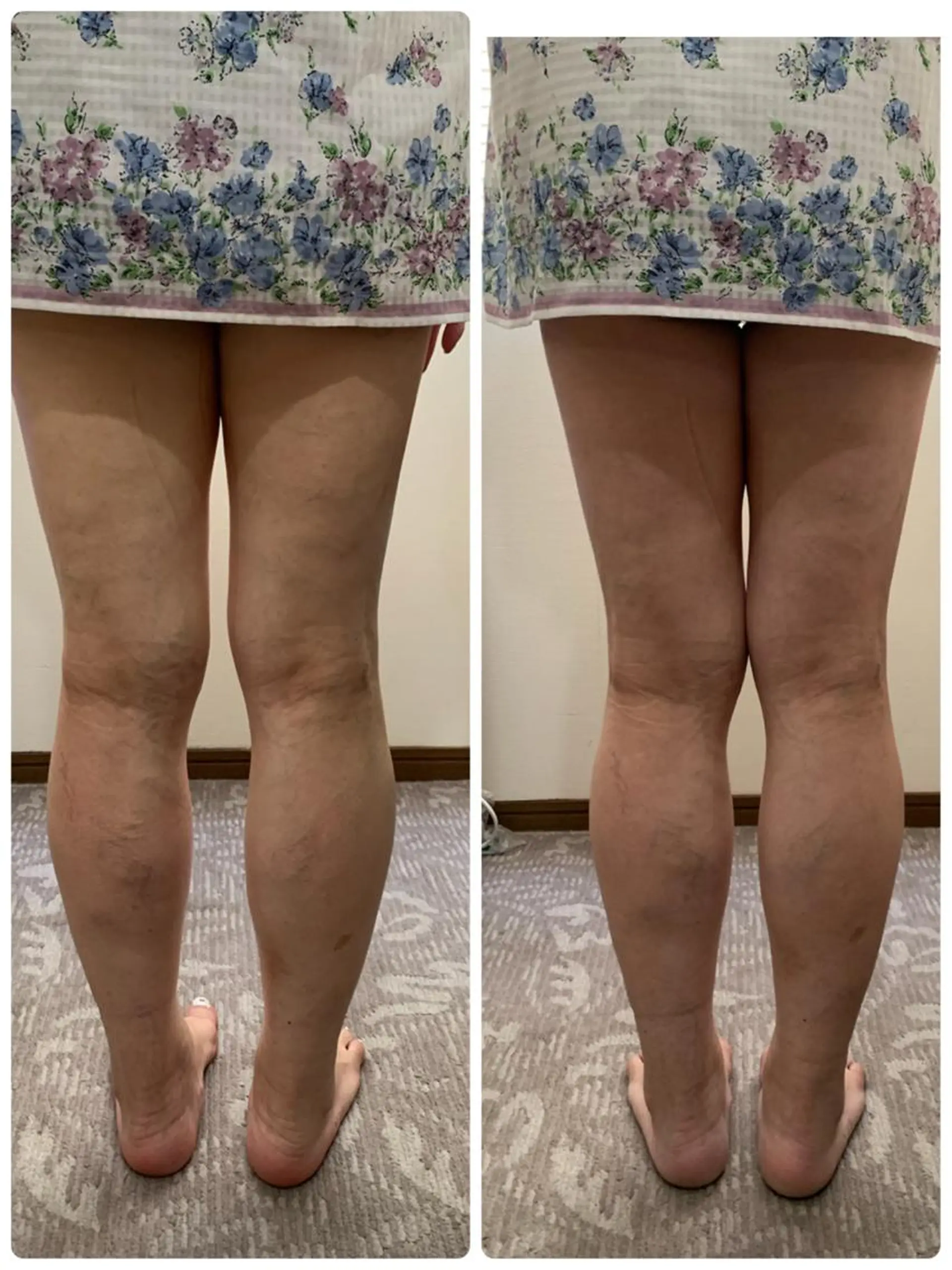 エステ espoir エスポワールのネイルデザイン