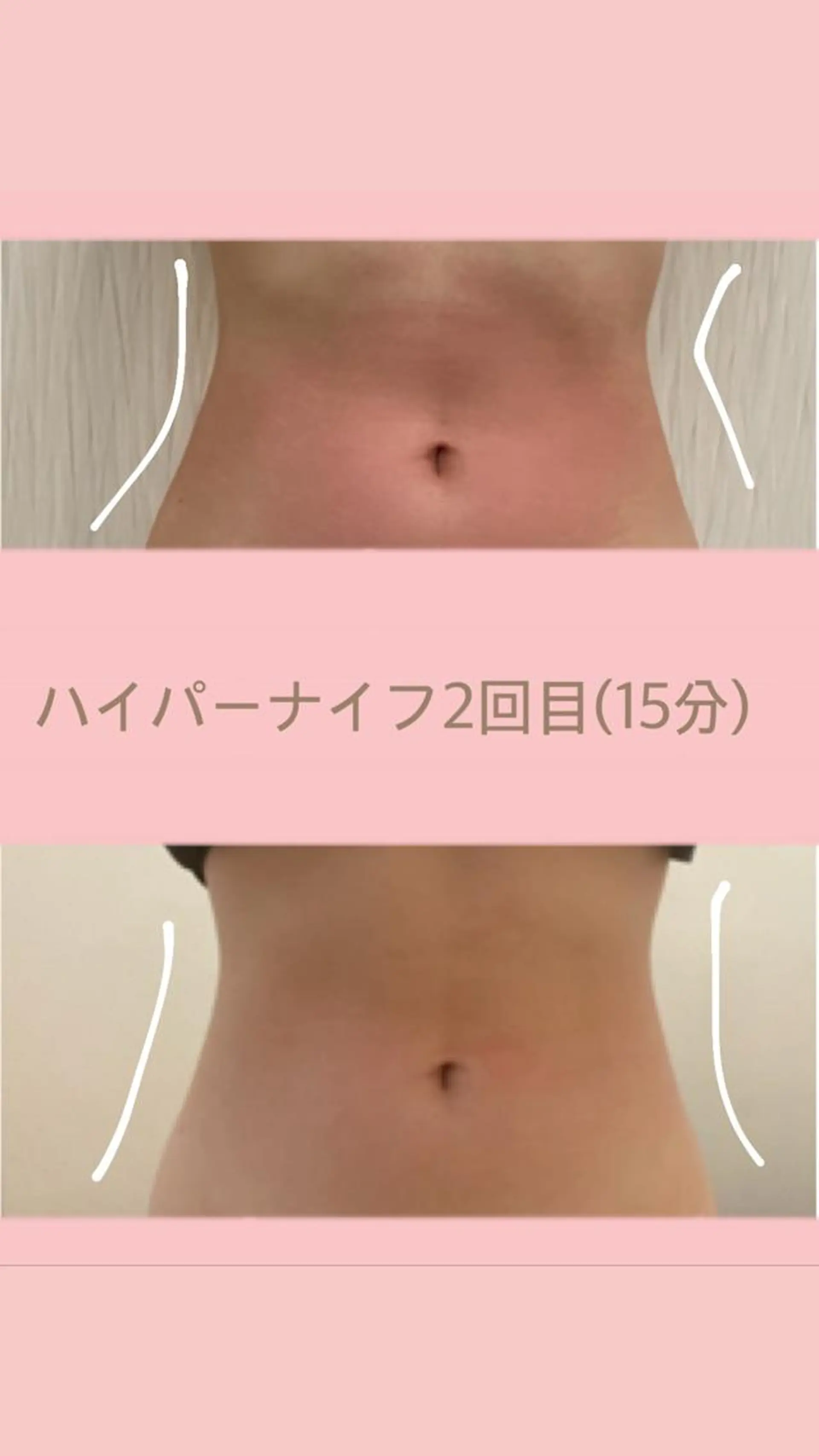 OPREA 栄店のエステ・リラクイメージ