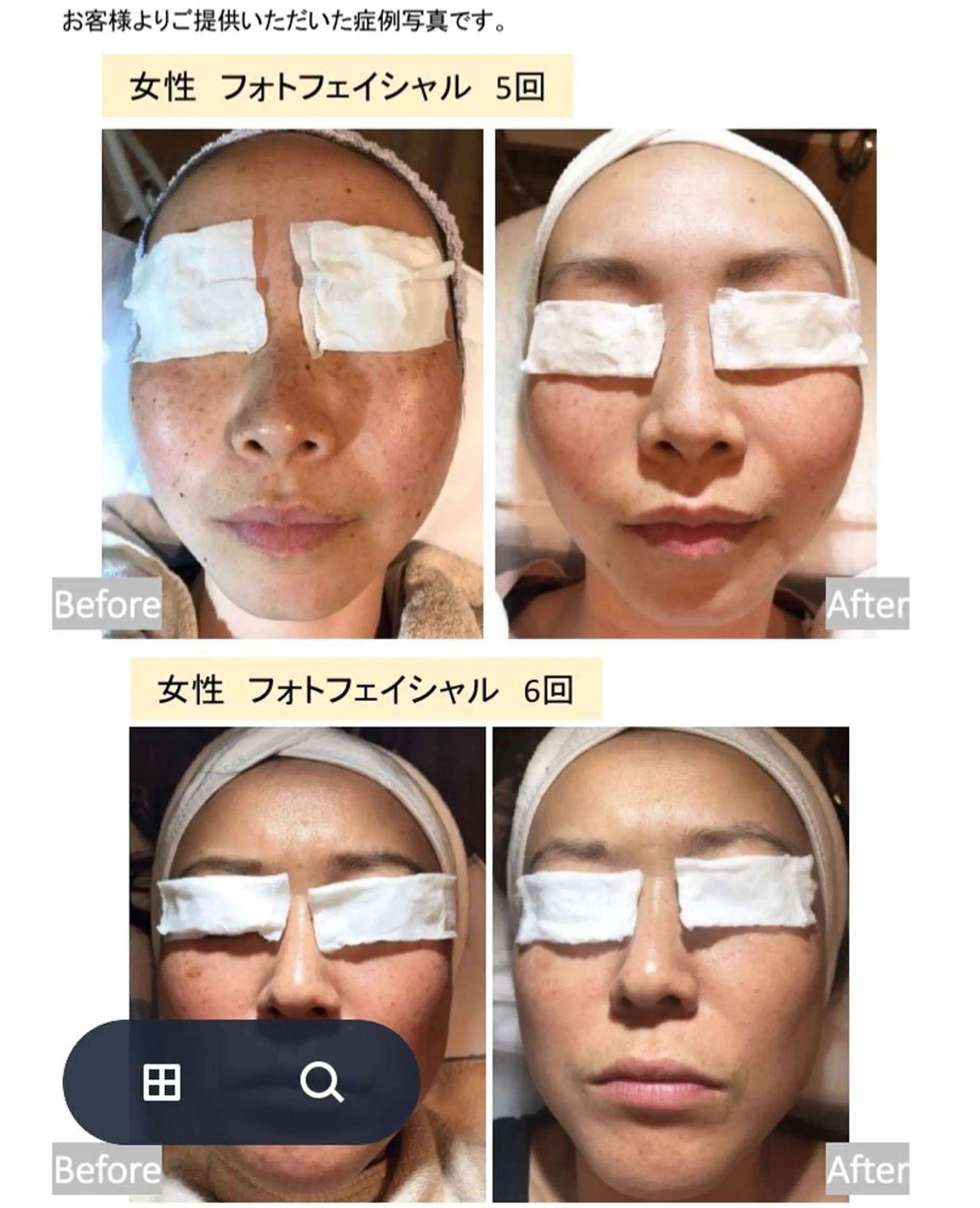 PARAFUSE.札幌店Brange所属・佐藤 陽子のエステ・リラクイメージ