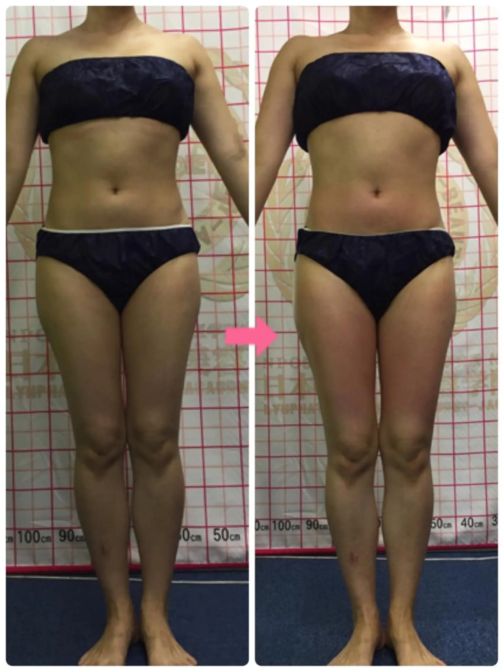 ロング カラー パーマ ヘアアレンジ メンズ キッズ ネイル マツエク・マツパ ‍痩身＆ボディ 結果出し🌟丹野のエステ・リラクイメージ