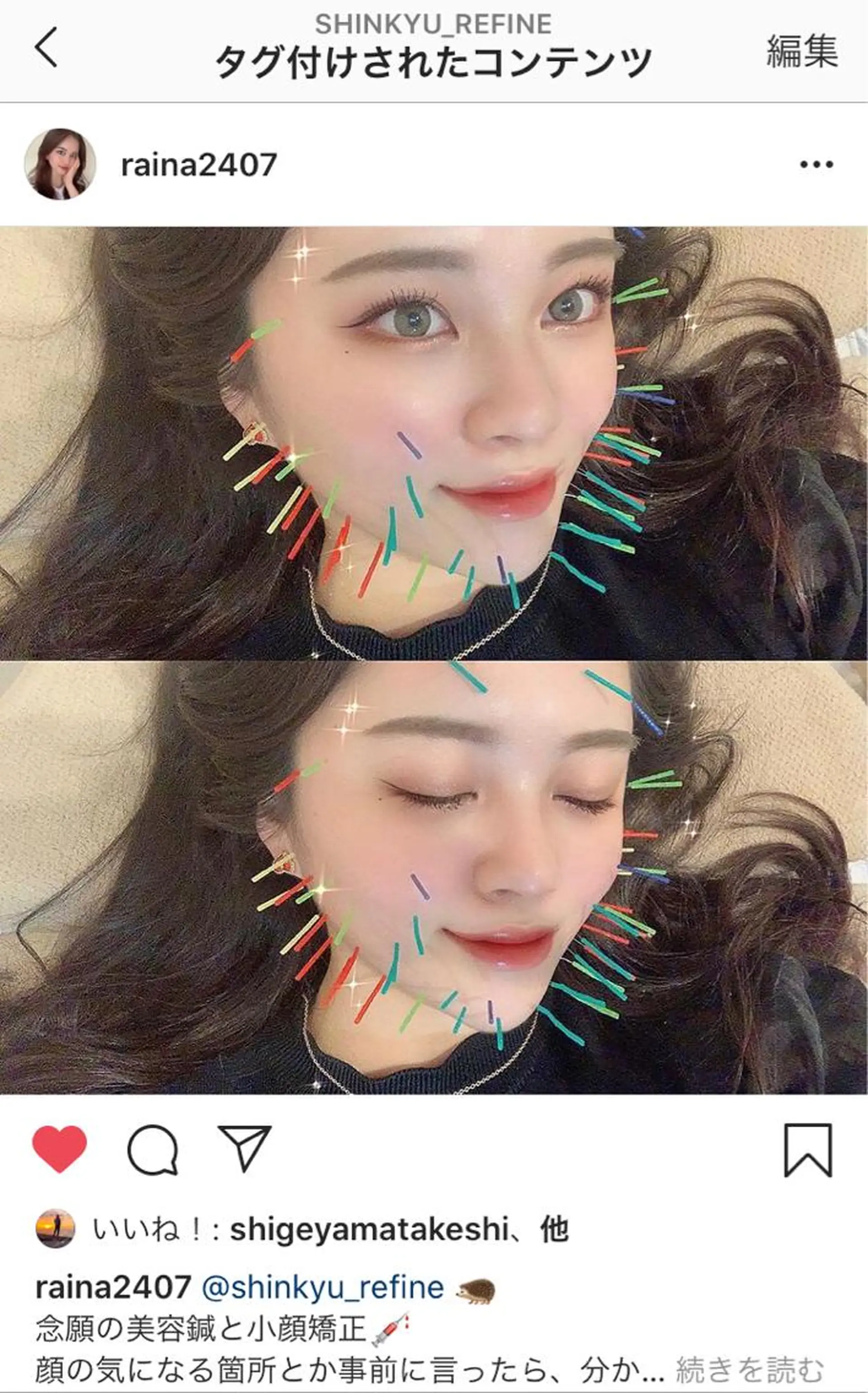 鍼灸整骨院Refine所属・鍼灸 Refineのその他イメージ