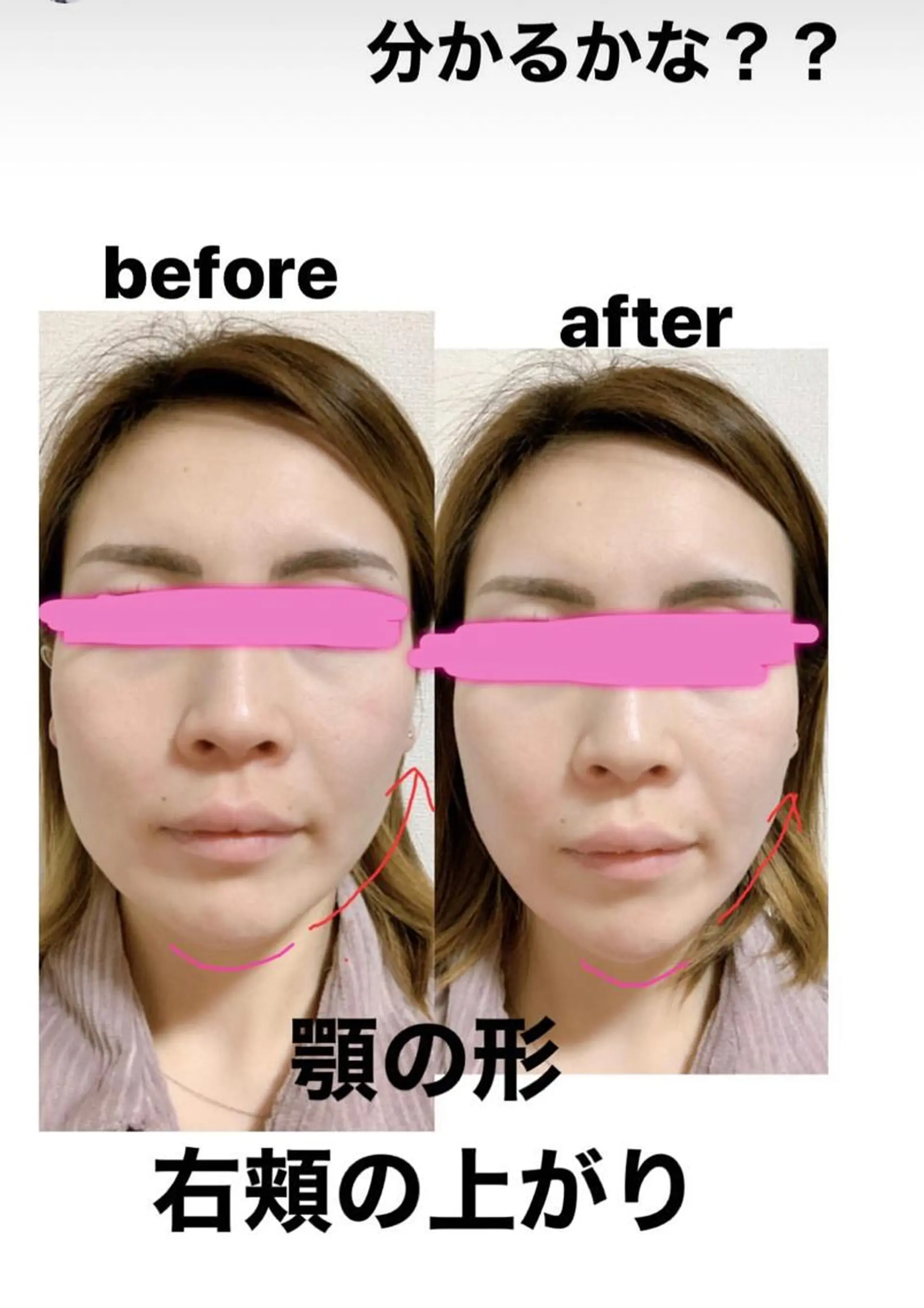 痩身/脱毛/ネイル HARUKAのエステ・リラクイメージ