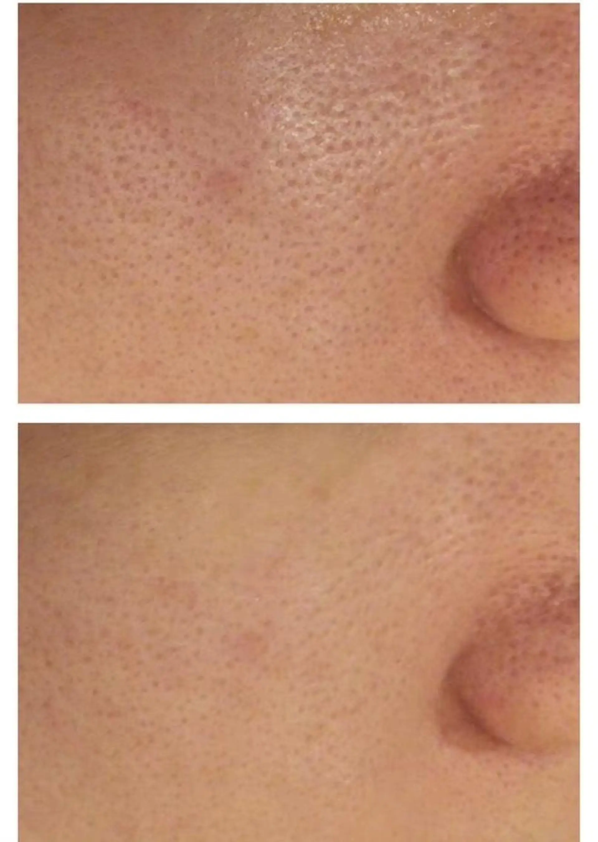 ロング カラー パーマ ヘアアレンジ メンズ キッズ ネイル マツエク・マツパ アイブロウ エステ リラク ニキビ特化型エステ 🍓最短で肌質改善のエステ・リラクイメージ