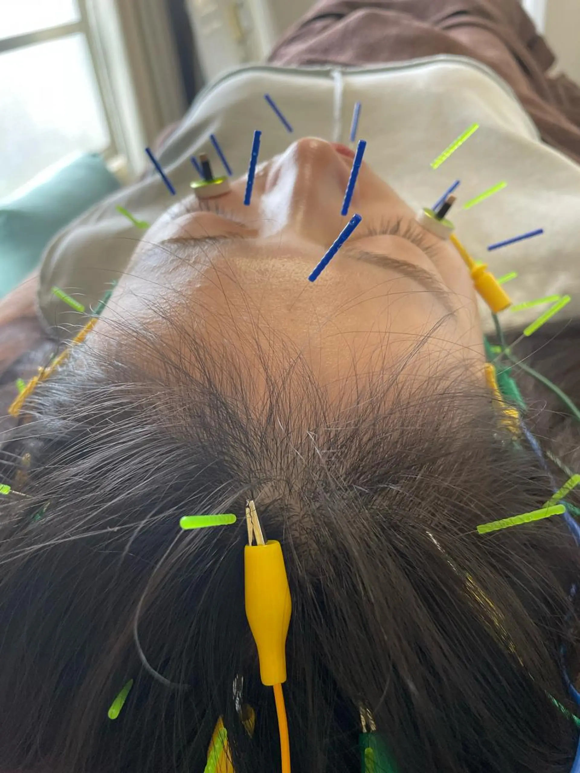 美容鍼灸サロン mahoroba院長のエステ・リラクイメージ