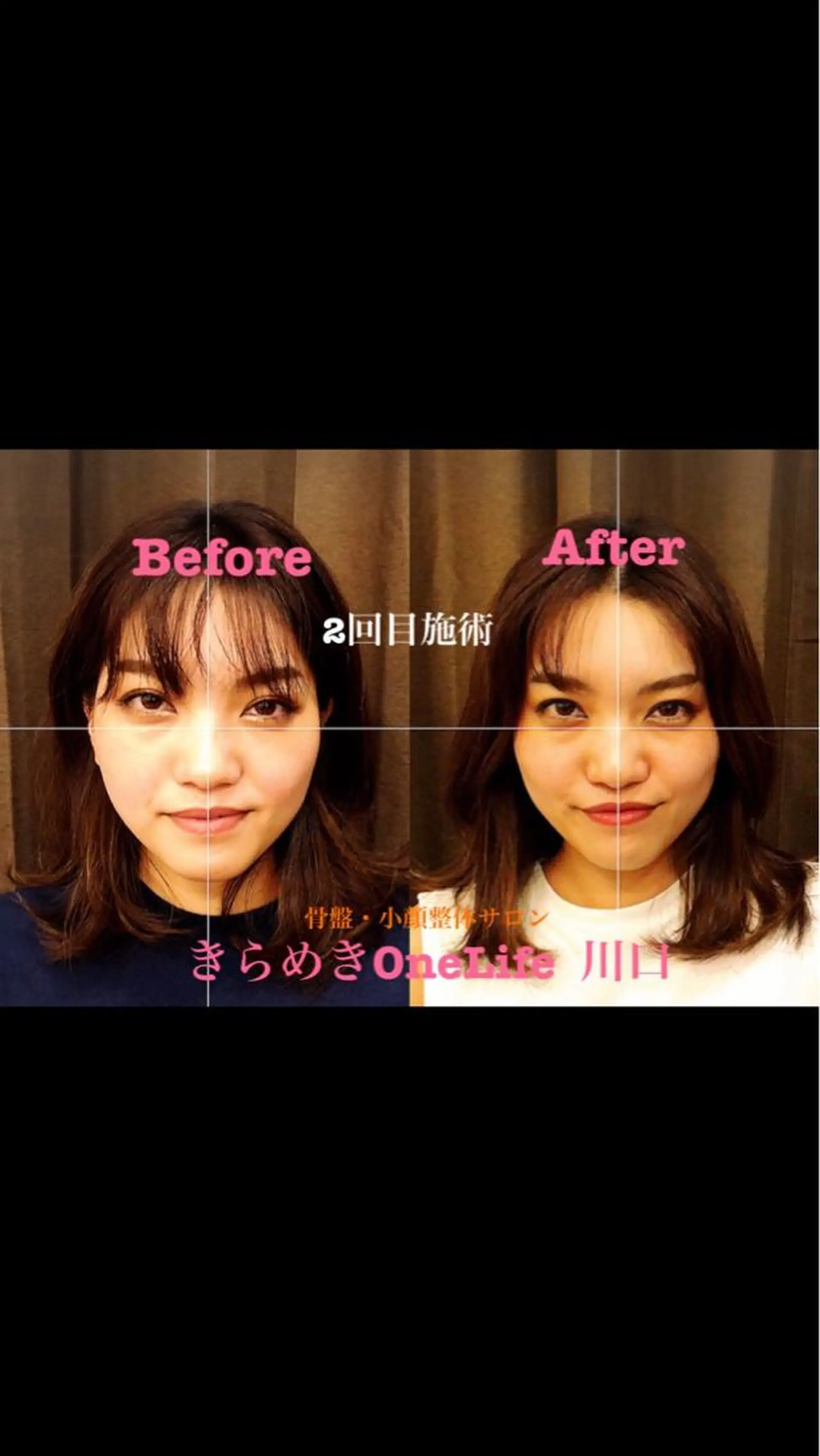 エステ リラク きらめきワンライフ Yumaのエステ・リラクイメージ