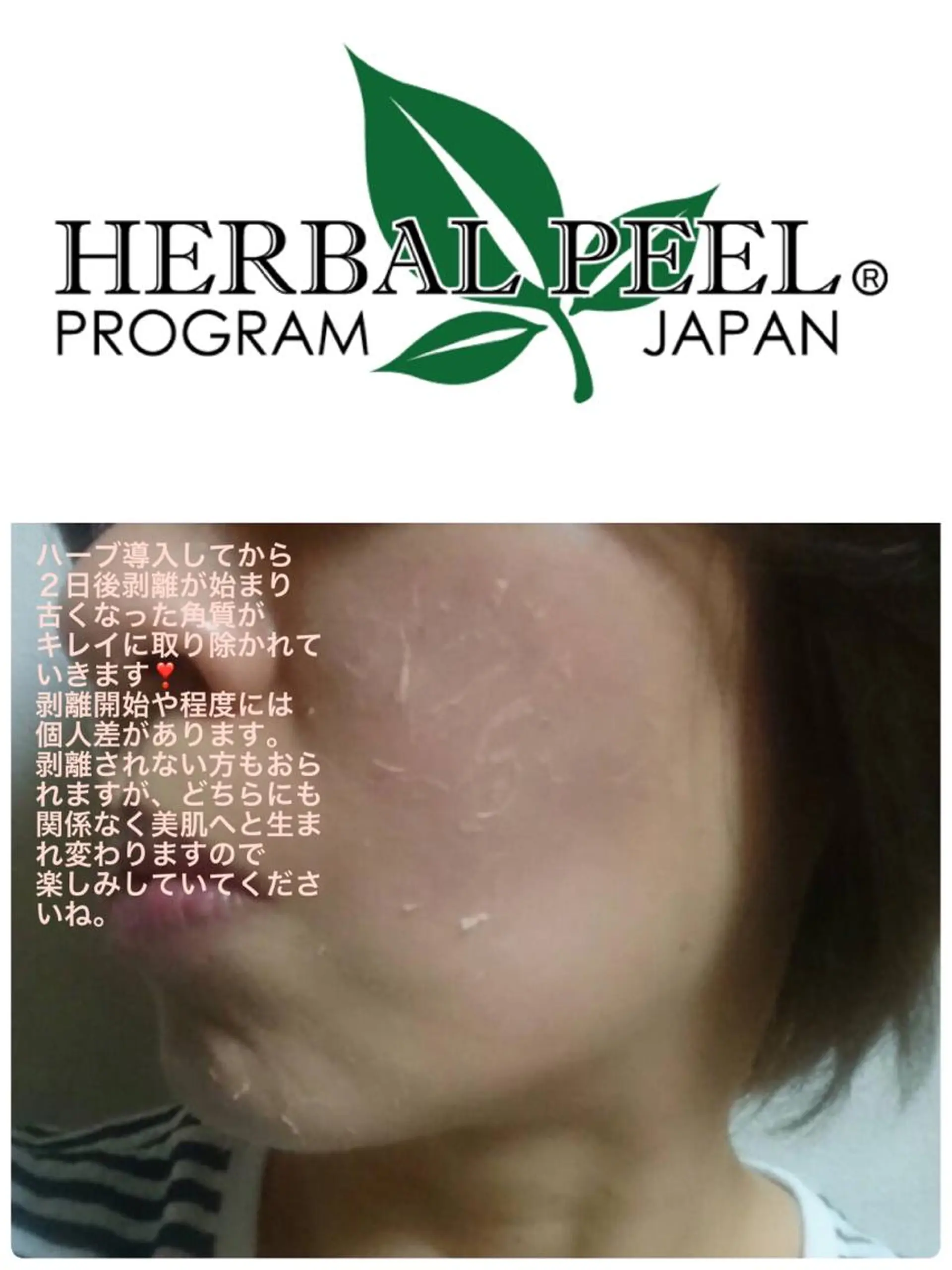 アクシア ビューティー サロン所属・究極のアンチエイ ジングサロンのエステ・リラクイメージ