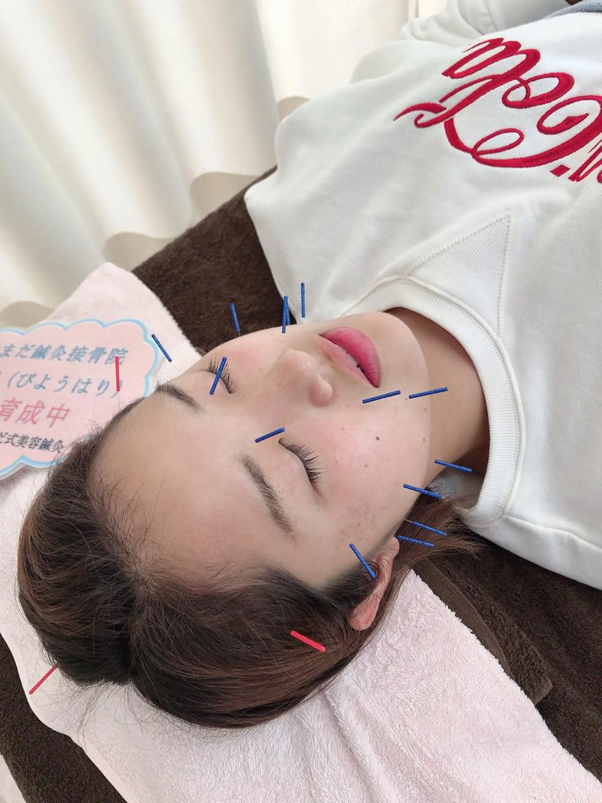 その他 やまだ鍼灸接骨院（やまだしんきゅうせっこついん）所属・山田 晃のエステ・リラクイメージ