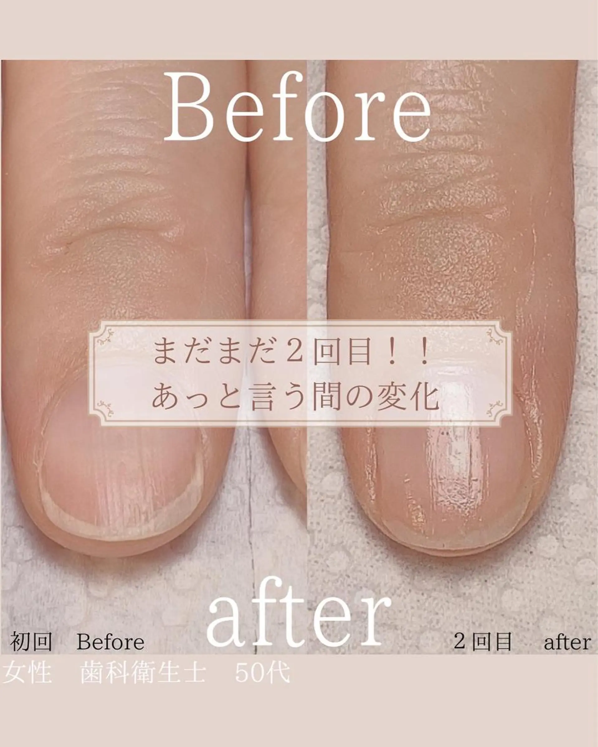 ネイル その他(ネイル) 木村 千晴のネイルデザイン