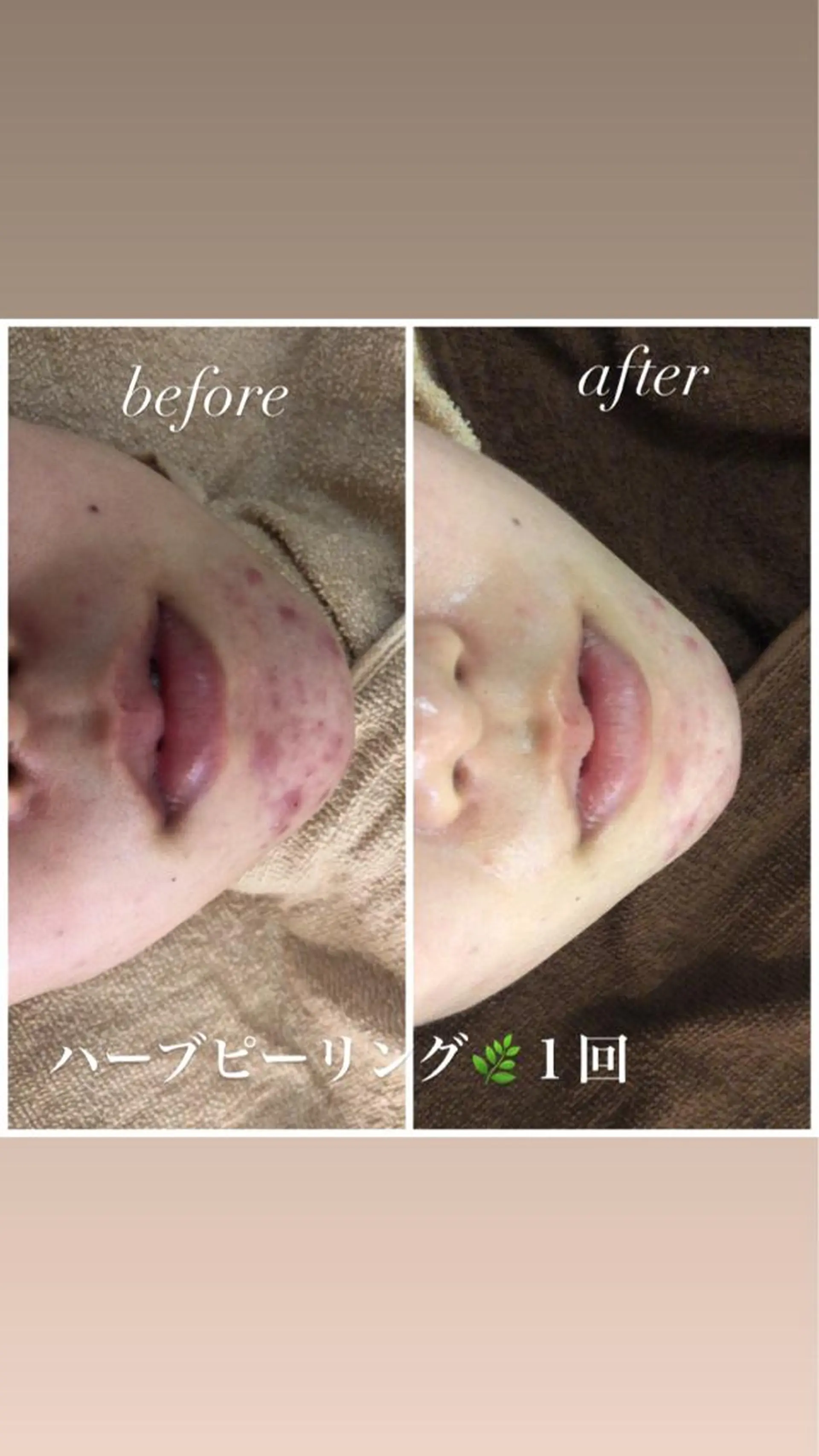 セミロング カラー パーマ ヘアアレンジ メンズ キッズ ネイル マツエク・マツパ Amaryllis 🌹のエステ・リラクイメージ