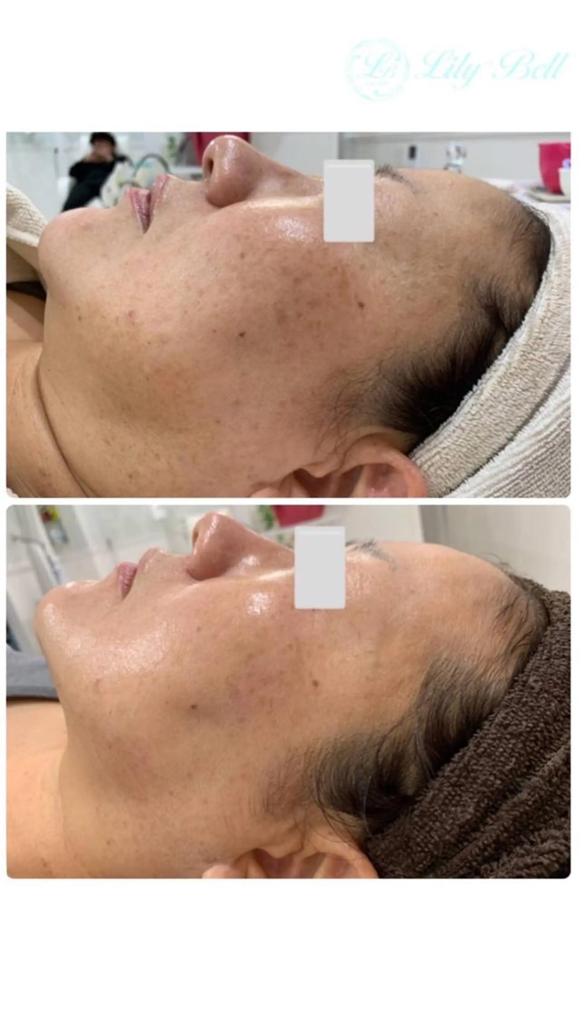 Lumiere despoir所属・Lumiere despoirのエステ・リラクイメージ