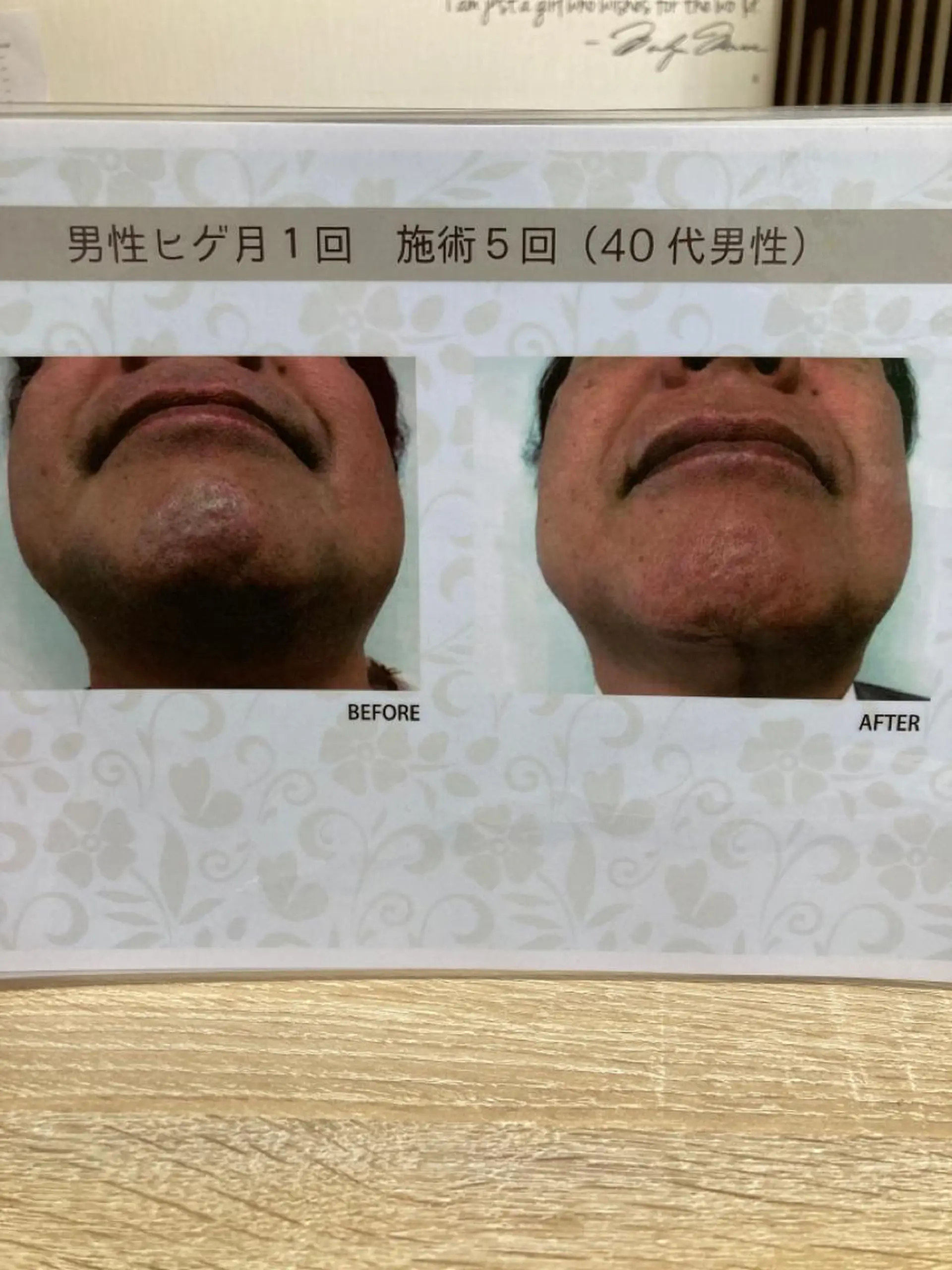 メンズ 矢野 つかさのマツエク・マツパデザイン