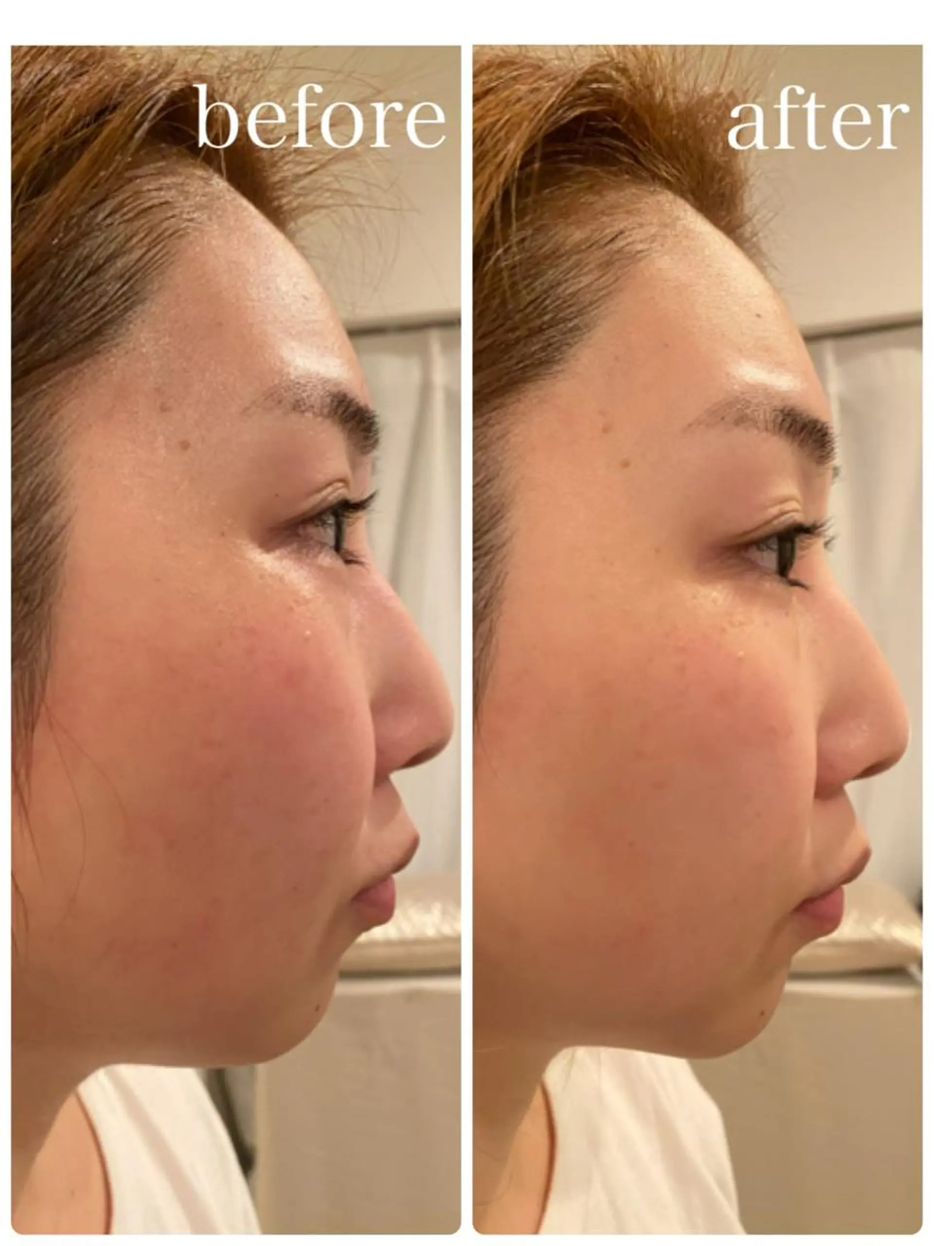 エステ 姿勢改善&beauty salon LAUB所属・姿勢改善 サロンLAUB奥村のエステ・リラクイメージ