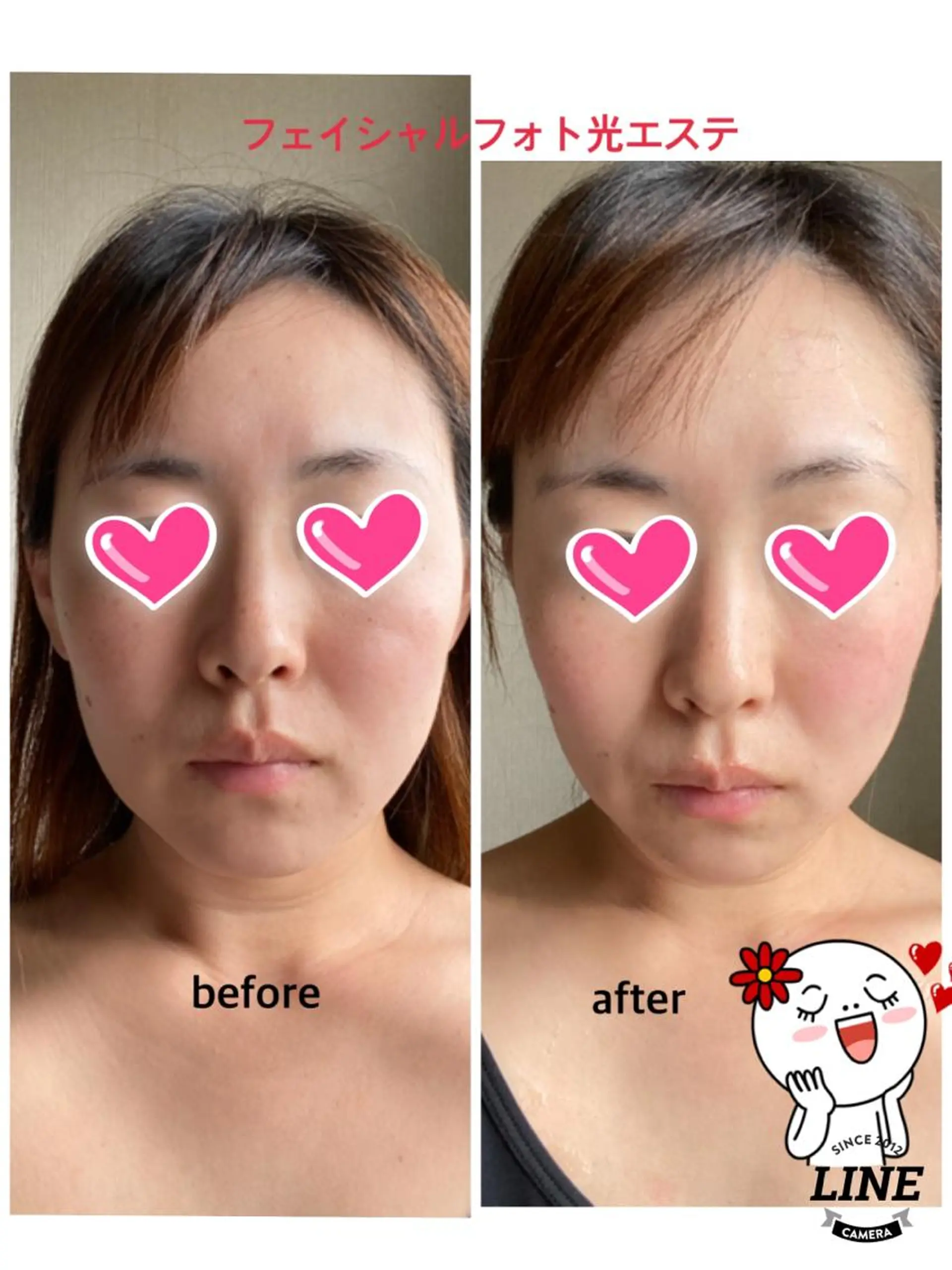 Silky ✖︎ Snow White｜エイジングケア＆美肌脱毛専門サロン所属・O 朋美のエステ・リラクイメージ