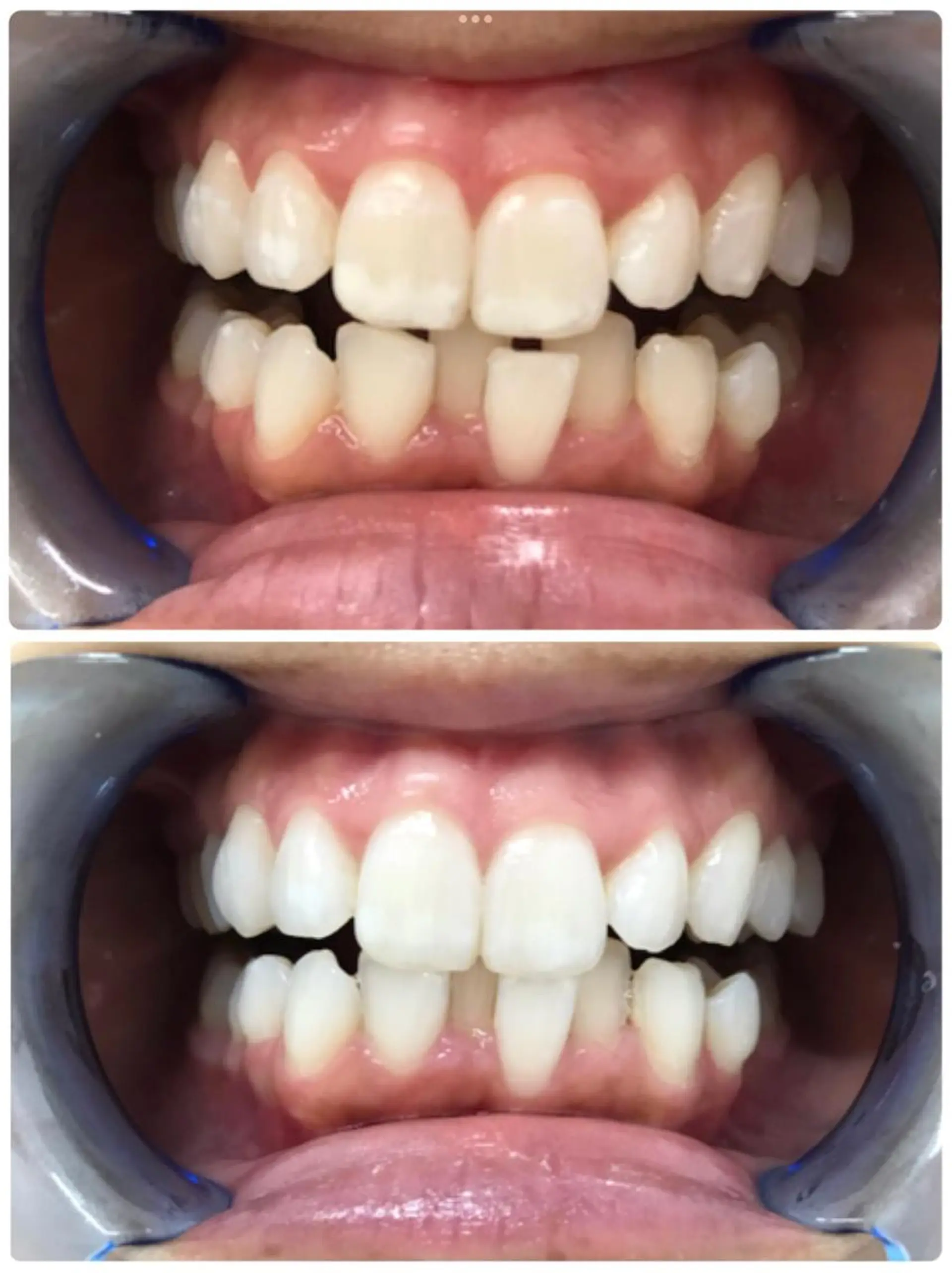 noel de mi 前川亜里沙のエステ・リラクイメージ