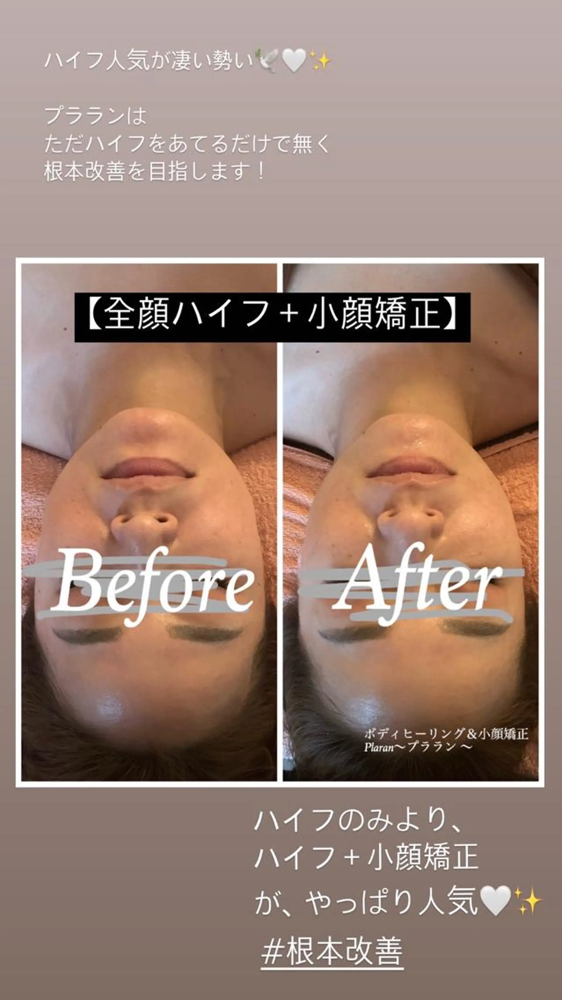 Plaran 〜プララン 〜のその他イメージ